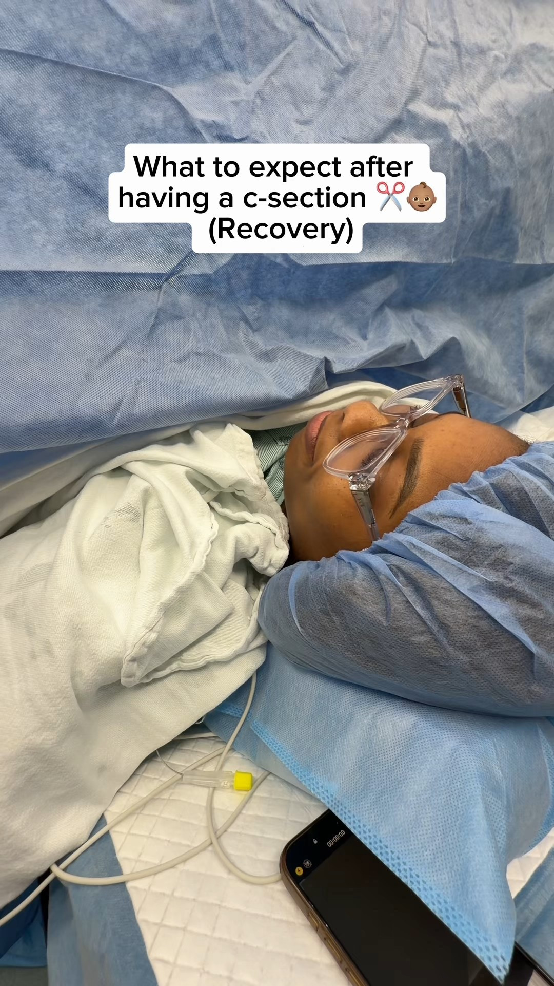 Not even going to sugar coat it. 😅
This is my experience as a 2x c section mom so far and I know that everyone’s is different. My c-section operation was a breeze, but like any major surgery, recovery can be a journey. Feel free to share your experience in the comments in a helpful way. Thankfully, all of this gave me my baby, so yes, it was worth it and I would do it again 😩

A few other things I thought of: 
📌 Along with the momentary nausea and vomiting, my whole body was itchy off and on for some hours. Something I think is a side effect from the epidural medication 🤔
📌 The itching sensation where the incision was made was something else. I read that it comes when an area is healing after surgery.
📌 I believe that with both vaginal and c-section, you can expect uterine bleeding for weeks after delivery. 
📌 I was in and out of sleep for a large majority of day 1 and would literally fall asleep mid convo 🤣
📌The stitches were taken out after two weeks at my OB visit and the site healed really well. 
📌 Expect some swelling in the face, legs and body. 

Drop any questions you have for me below and praying you have a smooth c section and recovery. ❤️

#LTKBaby #LTKstorytime #LTKmomlife