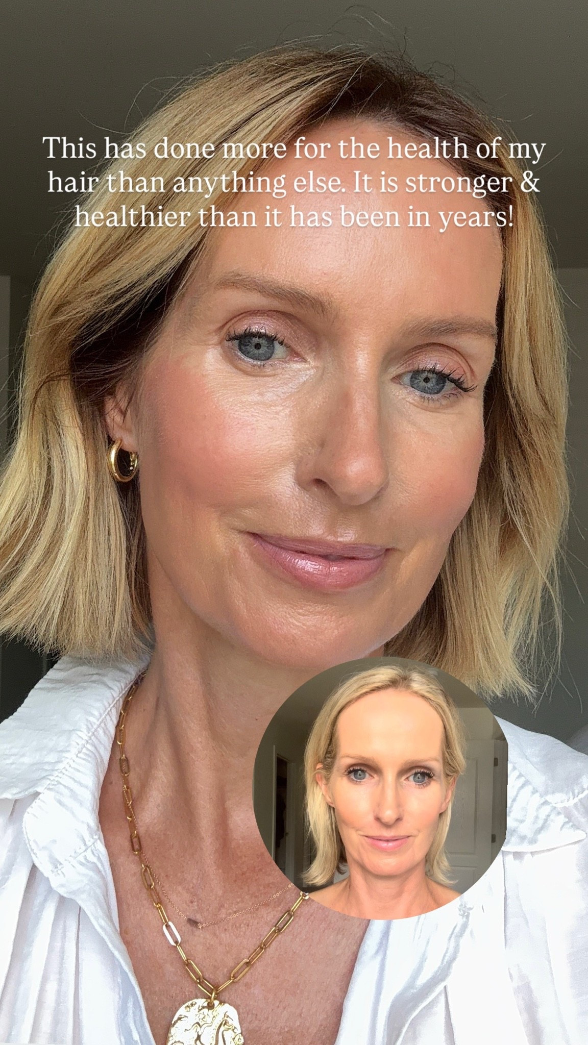 @nutrafol #ad
My hair is stronger and healthier than it has ever been thanks to this.
Consistency is key!

#LTKOver40 #LTKBeauty #LTKSaleAlert