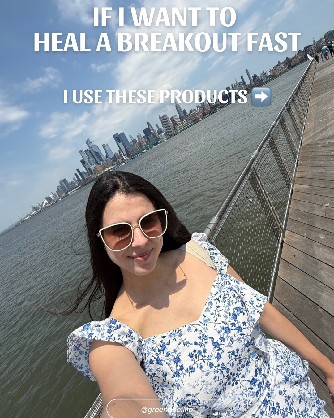 Comment FAST and I’ll send you my acne emergency kit! 

All these products are acne safe and gentle enough for even the most sensitive skin (like mine).

Breakouts will happen even when you’re trying to do everything right, so save this post for your next acne emergency!

Code GREENBOOTLIFE works for @clearstemskincare and @currentbody, and if you want a 15% off discount for @remedyskin, message me!

#adultacne #acneproneskincare #acnesupport #acnesafe #pimplesolution