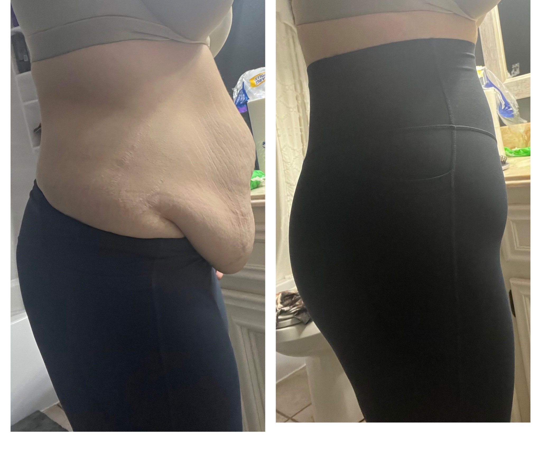 These leggings are MAGIC!! after loosing 150lbs and having a mom body, these leggings literally hide everything. 

#LTKActive #LTKmomlife #LTKfitnessgoals