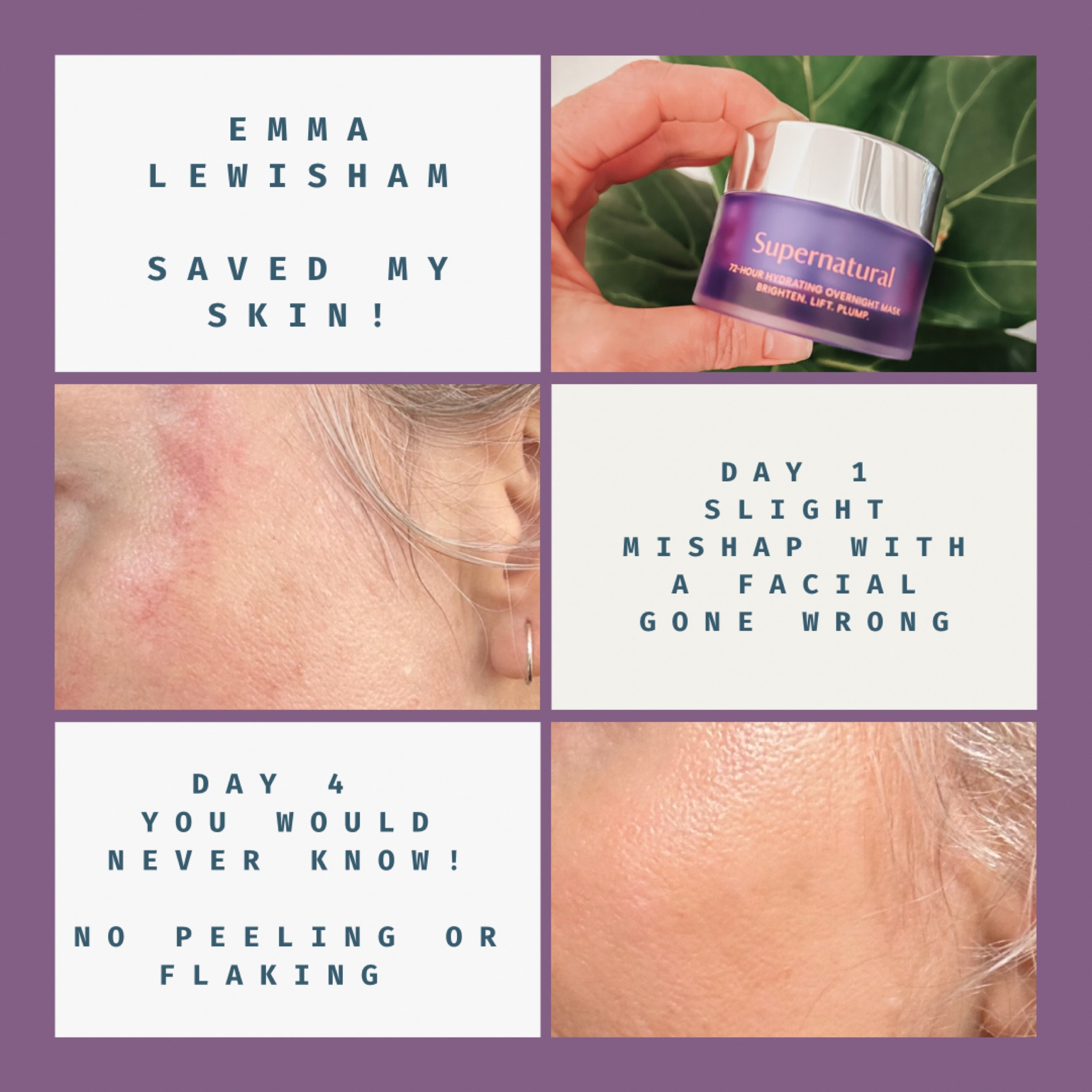This was my first time trying Emma Lewisham’s Supernatural 72-Hour Hydrating Mask. It was recommended to me after I’d had a facial gone wrong (I forgot to remind the beautician I was on Roaccutane). I honestly thought my face would peel off over the course of the next two weeks but within 4 days you wouldn’t even I’ve known. It never peeled, either. Cannot recommend enough! 

#LTKFind #LTKaustralia #LTKbeauty