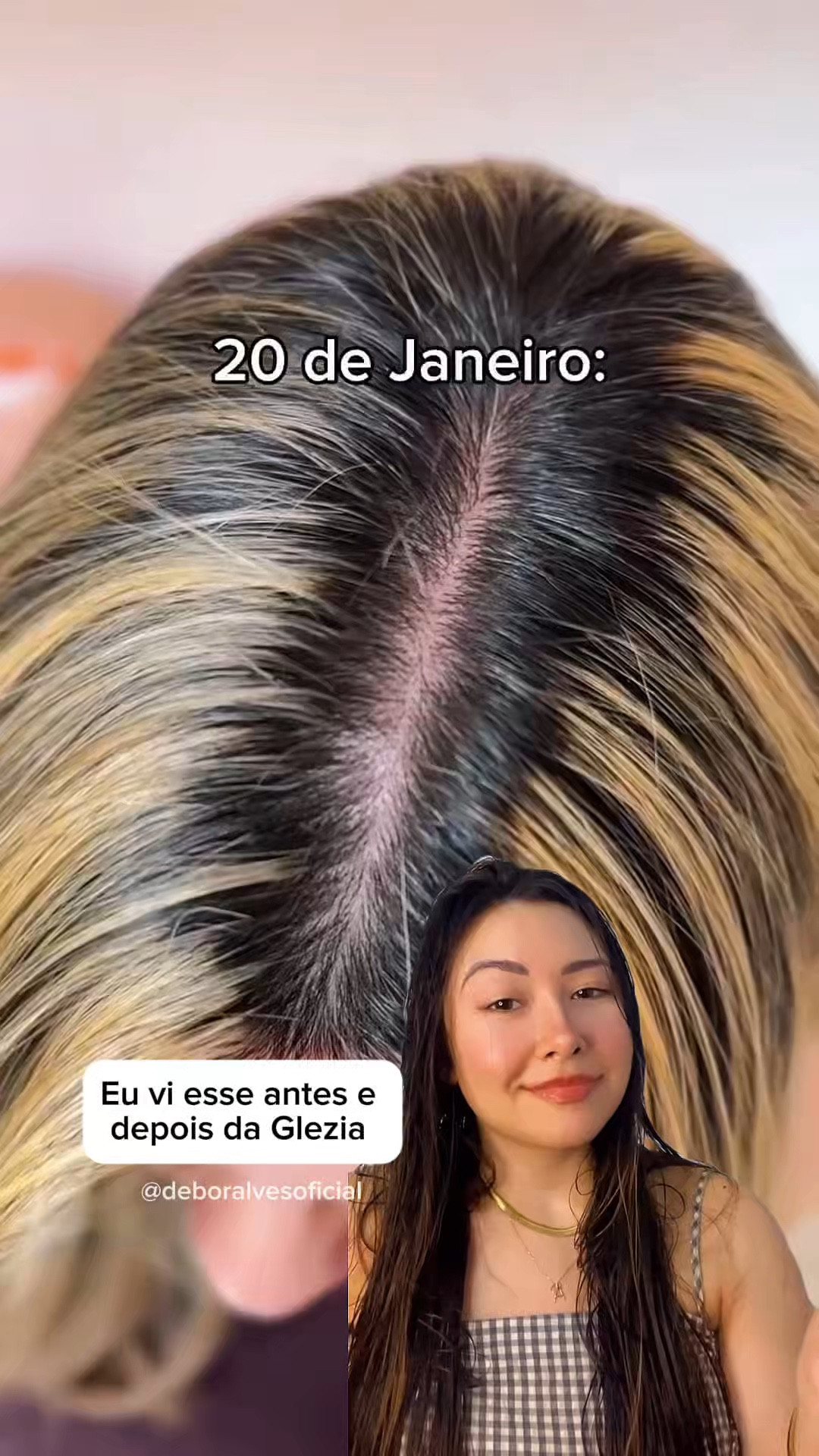Fiquei chocada com esse antes e depois 😳 Estou testando o novo tônico e hoje vou medir com a fita métrica! To postando todos os dias nos stories, 30 dias usando e dando dicas! ✨

Quer testar também? Comenta EU QUERO 👇 

Grupo vip do insta: https://lnkd.in/daMEKwn3 
Grupo vip do whats: https://lnkd.in/gkms93E3 

#tonicopoderoso #crescimentodecabelo #quedadecabelo #quedacapilar #goldspellcosméticos

#LTKbrasil #LTKbeleza #LTKpromo