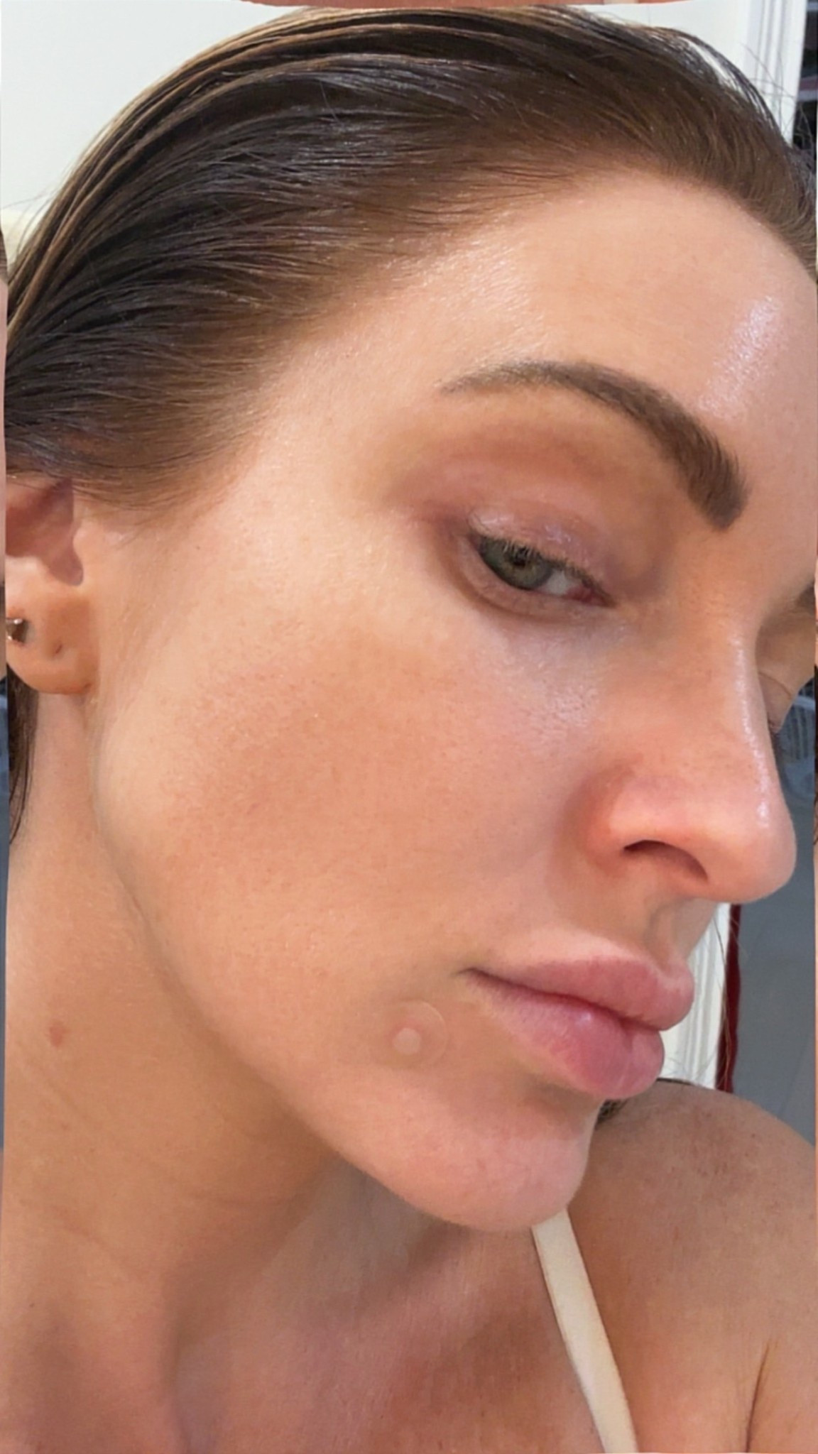 The best for pimples!! Look at all that stuff it brought up to the surface and out of my skin🤢 no wonder my breakouts go away so much faster!!

#LTKBeauty