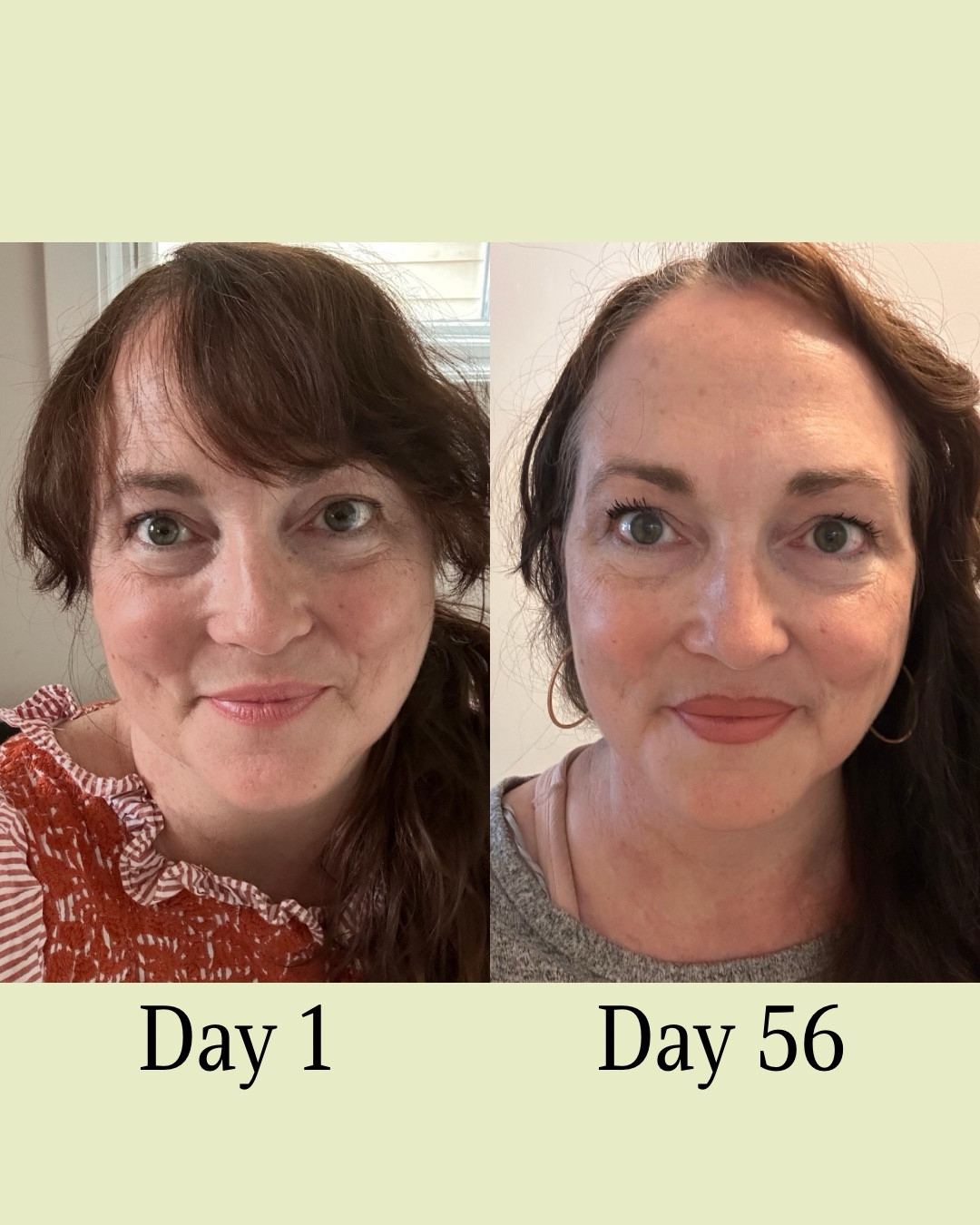 #LTKblackfriday Hey! It’s me! Down 8 lbs in less than 2 months. I take this supplement (2 pills) once a day, after a meal with a glass of water. That’s it. I haven’t changed anything else. I’m still in post concussion syndrome recovery so I can’t exercise yet BUT I am so impressed. Definitely recommend 

#LTKfitnessgoals #LTKselfcare