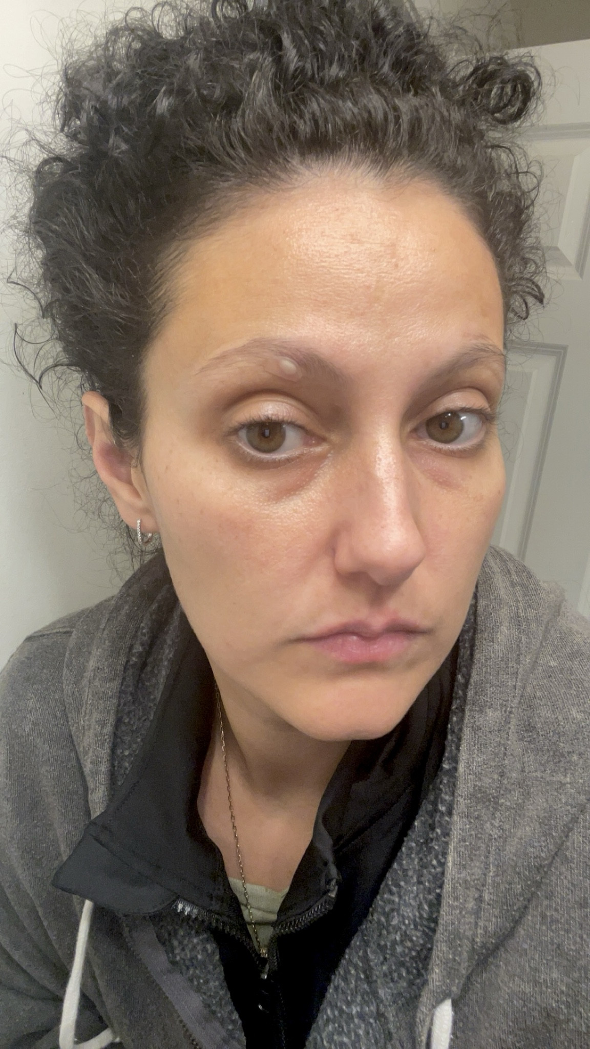 The amount of stuff this patch pulled out of my pimple is amazing! 🤌🏽🤩  

acne patch blemish control 


Best Seller

#LTKU #LTKbeauty #LTKtravel