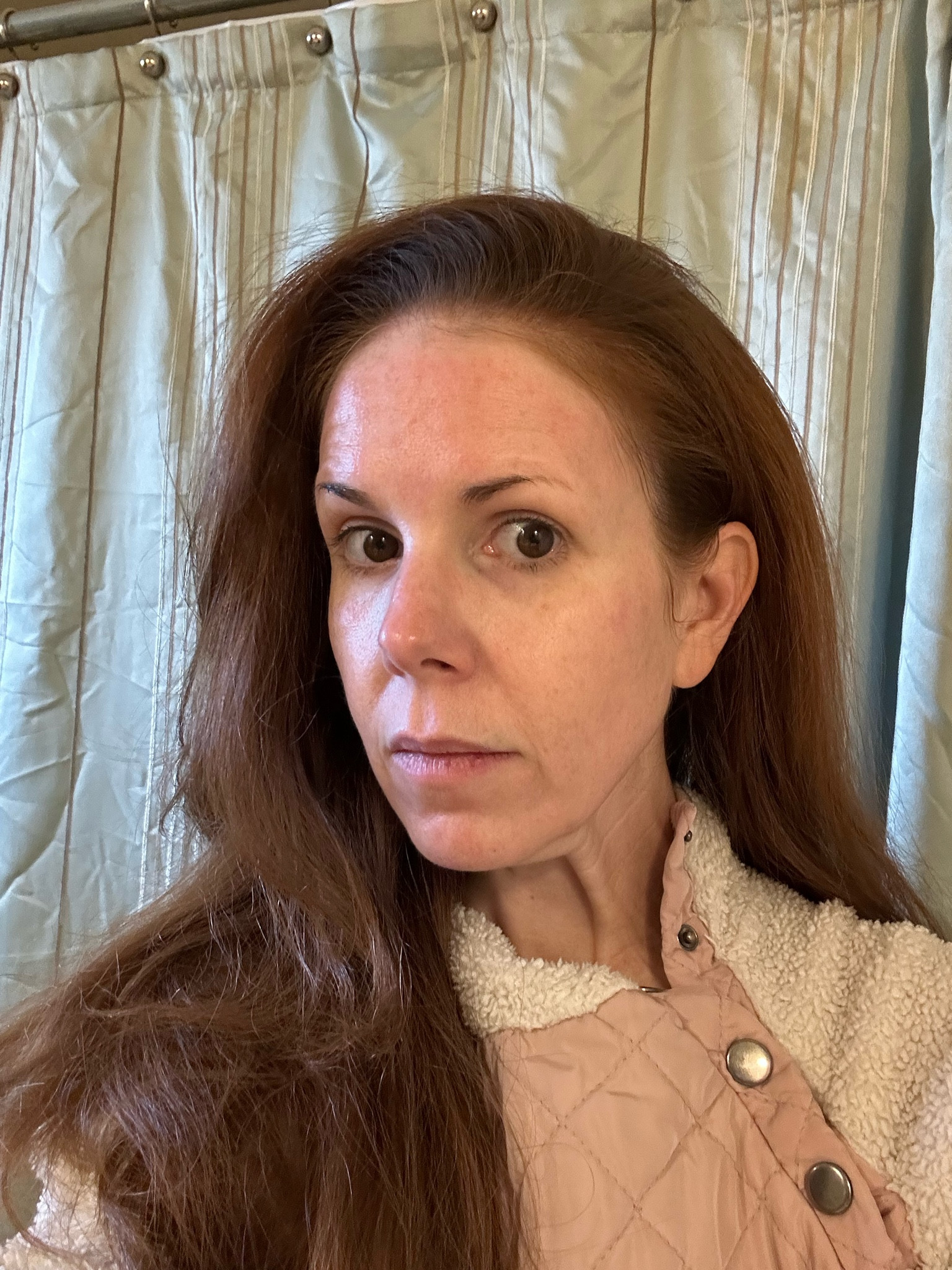 After peel #1 … I left it on for 2 minutes. 

#melasma #darkspots #finelines #skincare #chemicalpeel

#LTKunder50 #LTKstyletip #LTKbeauty