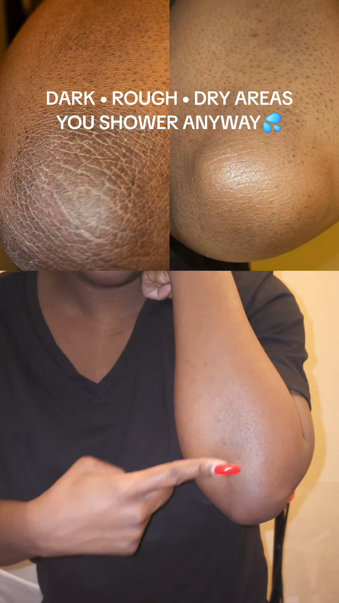 Literally just shower.You don’t need a 10-step routine for dark, rough areas.I didn’t add another step. I changed the soap.AM: gentle exfoliation. PM: corrective exfoliation.Same routine. Every day.If you see the orange cart above, both are available and affordable....#abbydames ....{dark areas routine, effortless body care, exfoliating body wash, chemical exfoliation body, aha bha pha body wash, body care routine, elbow care routine, knee care routine, underarm care routine, dry rough skin, textured skin appearance, smooth looking skin, body exfoliation routine, morning night shower routine, habit stacking skincare, low effort skincare, shower routine upgrade, body wash routine, affordable body care, consistent skincare routine, viral body care, tiktok shop body care, tiktok shop finds, ugc skincare content, bahamian creator skincare, austin influencer skincare, fall body care routine, winter body care routine, exfoliating wash routine, gentle exfoliation body, corrective exfoliation routine, dark areas appearance, rough skin help, body care tips, everyday shower routine, simple skincare routine, no extra steps skincareResults may vary. Disclaimer: This content is for informational purposes only and is not medical advice. Before starting any new skincare or body care routine, consult your primary care physician or a qualified healthcare professional, especially if you have sensitive skin, allergies, or existing skin conditions. Final price, discounts, and shipping may differ based on your TikTok account, available coupons, and any promotions.}

#LTKBeauty #LTKmorningroutine #LTKselfcare