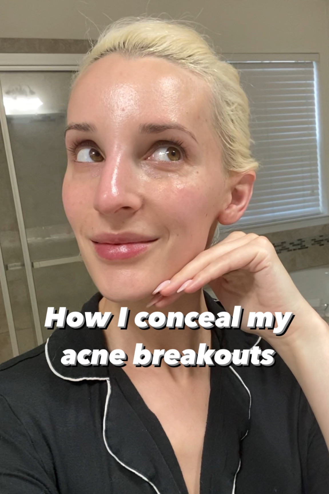 How I cover my blemishes - I found the best products! 

#LTKFind #LTKbeauty #LTKunder50