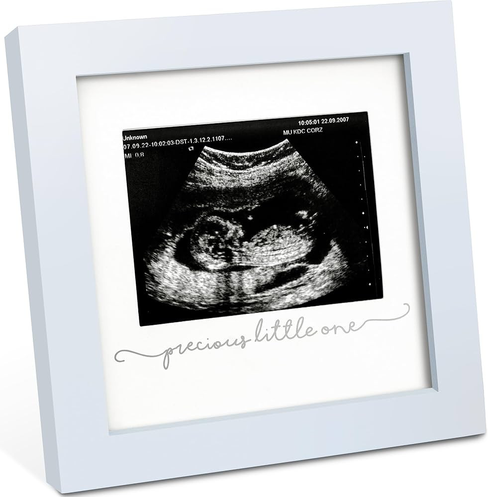 KeaBabies Baby Sonogram Picture Frame - Modern Ultrasound Frame for Mom to Be, Pregnancy Announce... | Amazon (US)
