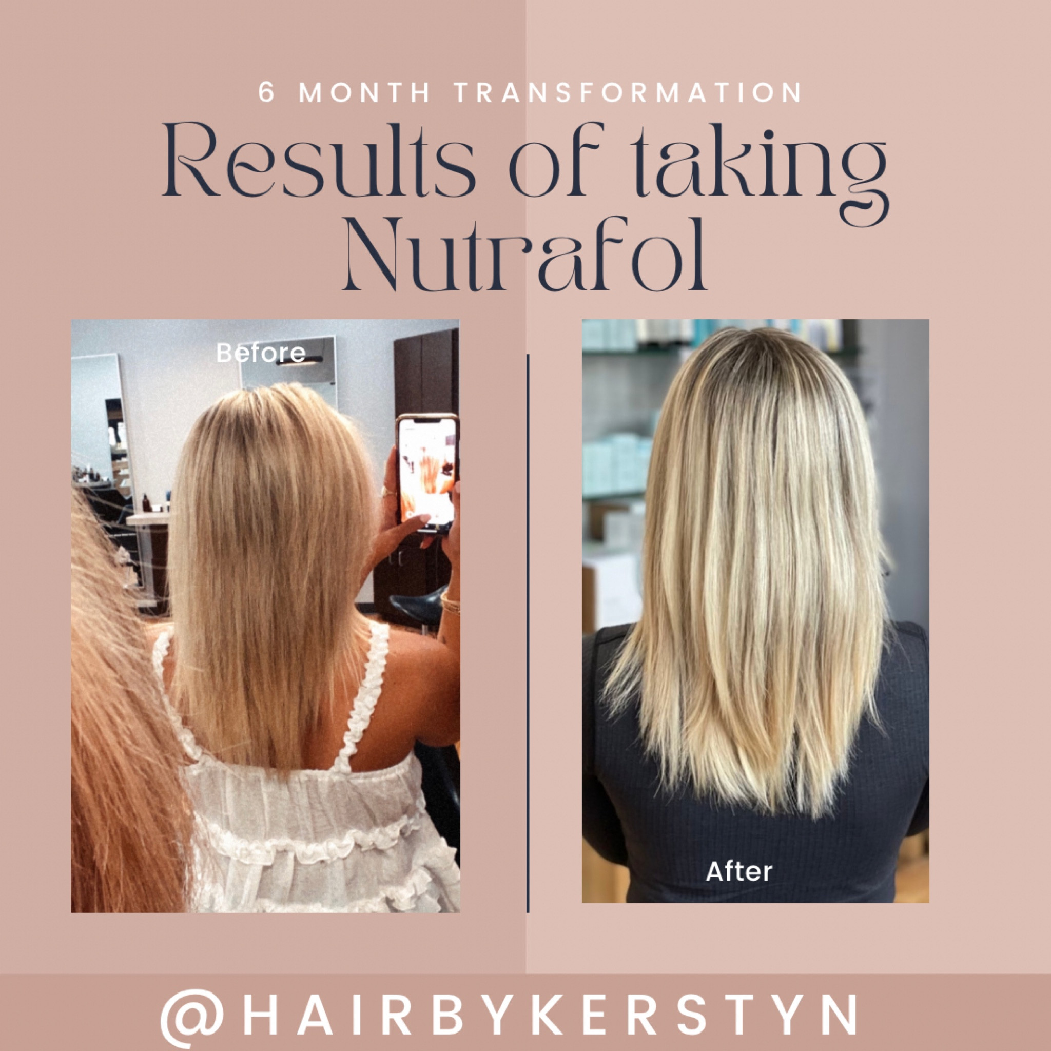 My secret to having healthy hair! Healthy scalp + insides = healthy hair! 


#LTKbeauty #LTKFind