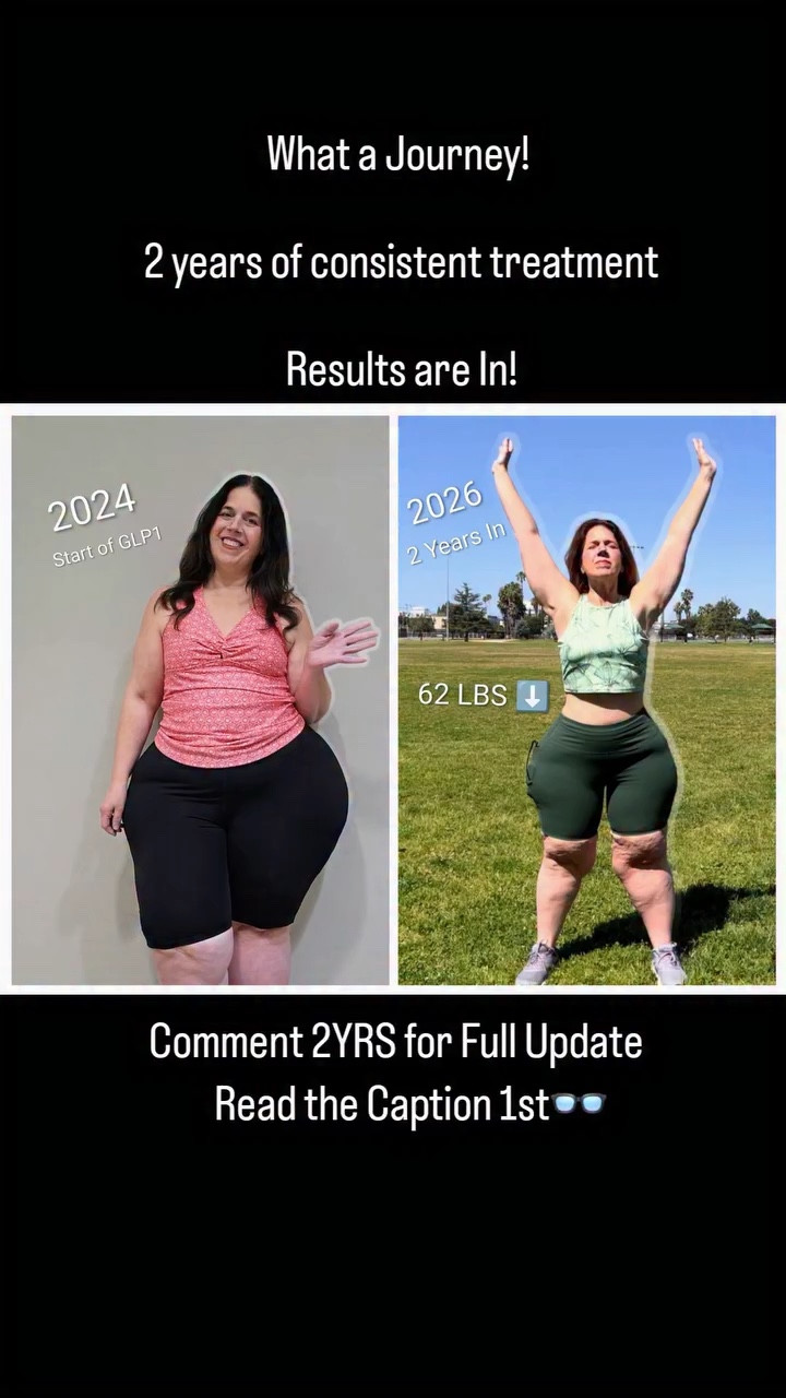 TRIFECTA!

May is National Asthma & Allergy , Mental Health  AND Ehlers-Danlos Syndromes (EDS) and Hypermobility Spectrum Disorders (HSD) Awareness Month and I am personally challenged by all three! 🌐

June is Lipedema and Mast Cell Disease Awareness Month and these are additional components along my fight against Obesity.💜

The battle against the disease of Obesity began when I was six and looked different in my dancing costume for my 1st recital. Likely, Lipedema was already rearing its presence which definitely affected my mental health and internalized weight bias and so the cycle began.💃

Today, I am proud to say I have been back in the game of implementing solutions that push back against the disease of obesity with medical intervention for the past 2 years and that has been transformative. I am back to 210 LBS down from my highest weight of 
404 LBS in 2003, 22.5 yrs ago before my Rouen-Y gastric bypass bariatric surgery.🦋

I am hopeful after this past 6 months of a kind of plateau that my body has recalibrated and is ready to start another new chapter. I know my body had a great deal of stress to gonup against since September and I am so thankful that for the first time in my life, I DID NOT gain any weight as a result of a major life change when my son went off to college.🙏

What's your experience been with GLP1? We would love to hear about it in the comments so we can all learn more together⬇️

Comment 2YRS for the Full Update🥳

#weightlosscommunity #bariatriccommunity #weightlosssuccess #lipedema #glp1community

#LTKMidsize #LTKselfcare #LTKActive