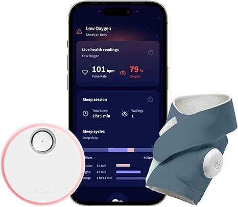 Owlet Dream Sock® - FDA-Cleared Smart Baby Monitor - Track Live Pulse (Heart) Rate, Oxygen in In... | Amazon (US)