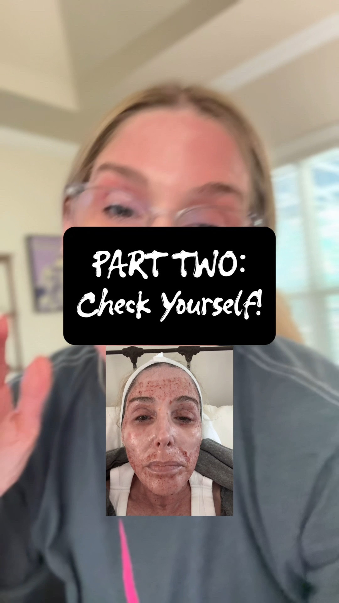 Follow along on my CO2 laser journey! Get the TIPS AND TRUTH from someone who has been through it! @Prequel Skin @Dermstore 

Have any questions? Drop them below! ⬇️

#LTKvlog #LTKselfcare #LTKOver40