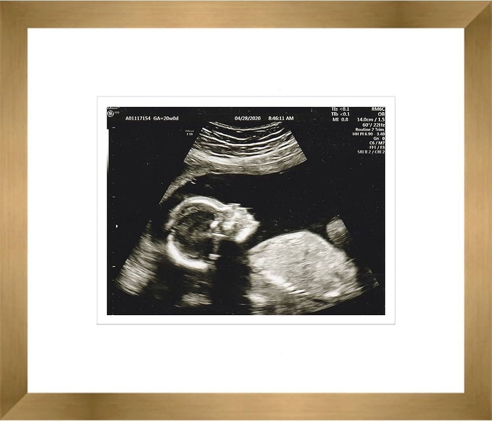 CountryArtHouse 6x5 Gold Sonogram Solid Wood Frame with White on White Mats with 1 Opening to Dis... | Amazon (US)