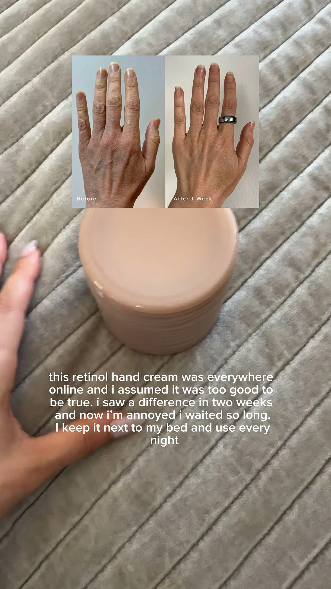 This retinal handcream combined with the niacinamide has made such a huge difference with the look of my hands
￼

#LTKOver40 #LTKBeauty #LTKstorytime