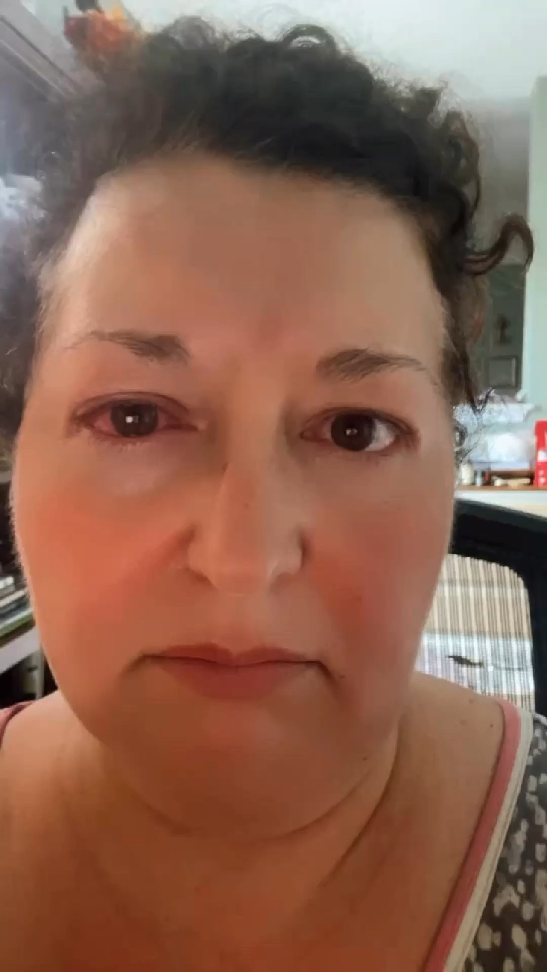 pink eye is not fun. thank God i had what i needed on hand!

#LTKFamily #LTKFindsUnder100 #LTKFindsUnder50