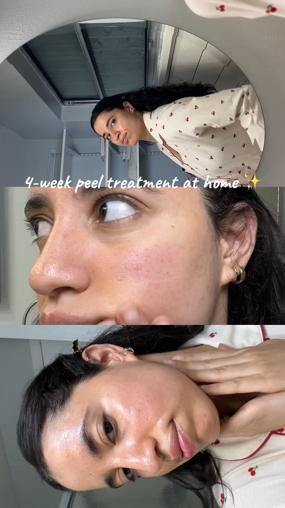 My peel diy right at home with Thome 

#LTKBeauty #LTKdayinmylife #LTKgrwm