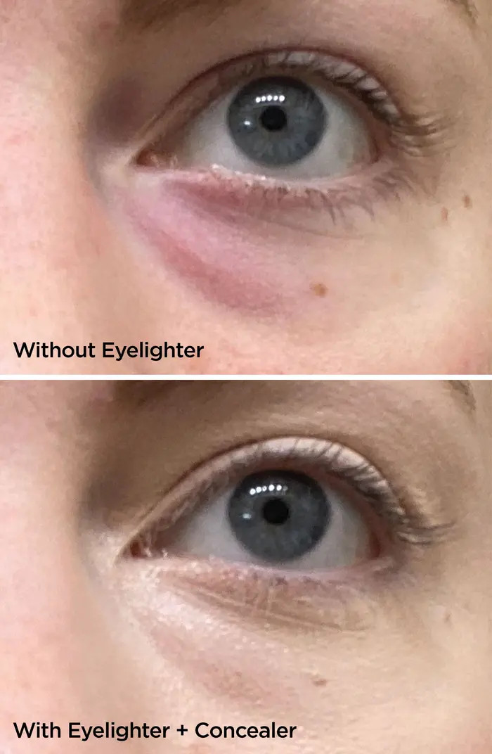 The Eyelighter Concentrate Smoothing, Brightening Serum & Depuffing Tool | Nordstrom