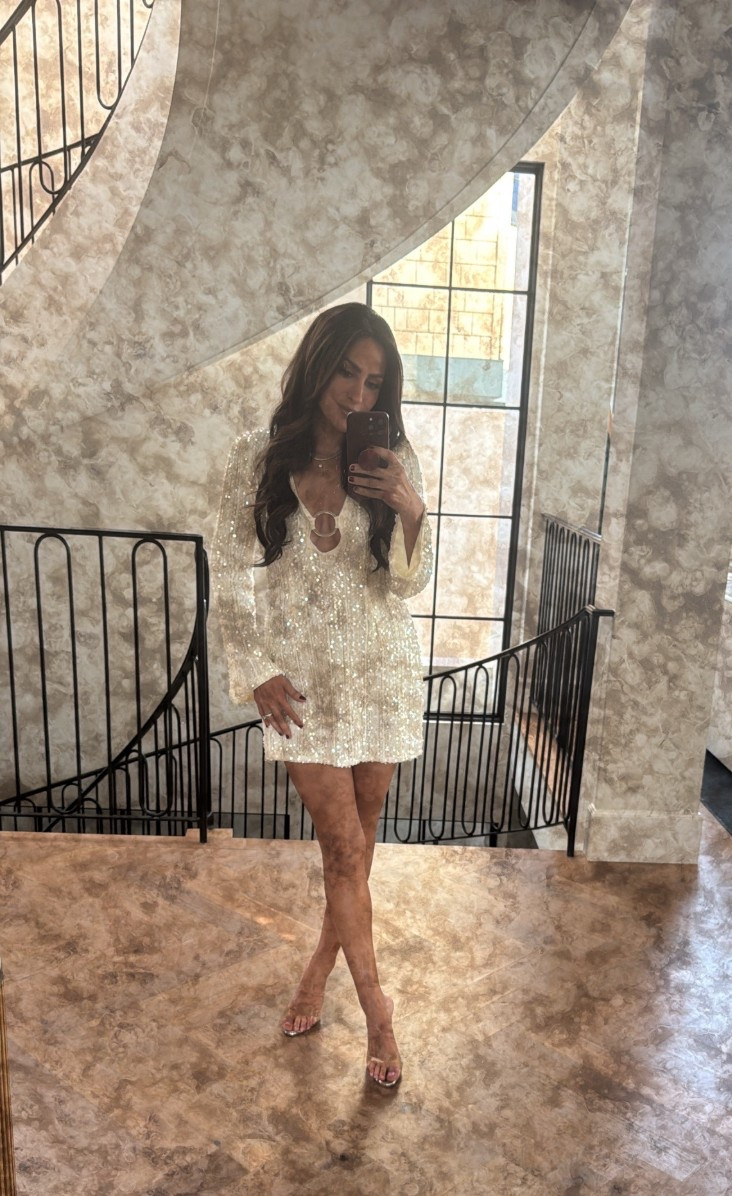 Dress size small! 



#LTKootd #LTKFestival #LTKOver40