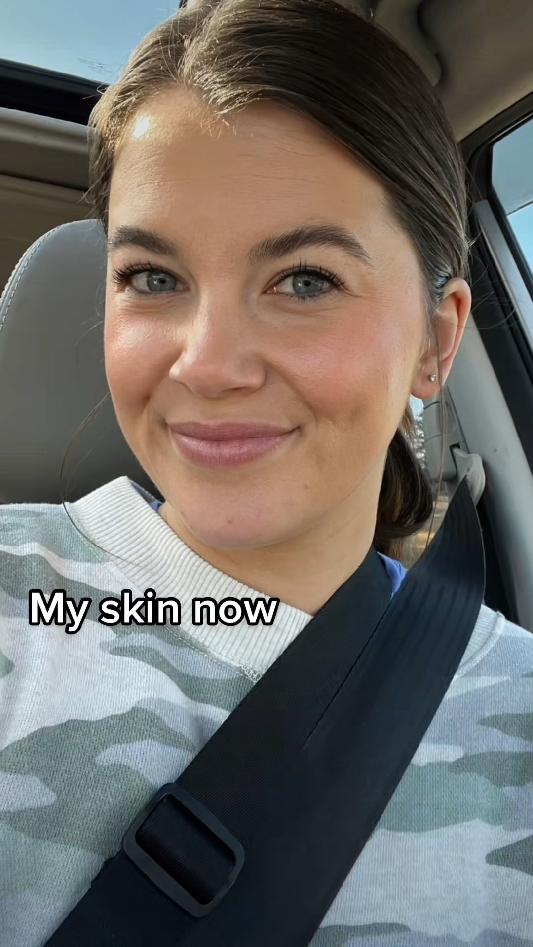 Products that got my skin to this 💗
#cleanbeuty #cleanskincare 
Crunchi.com/elliebecker for $10 off your crunchi order 💗 

#LTKstyletip #LTKbeauty