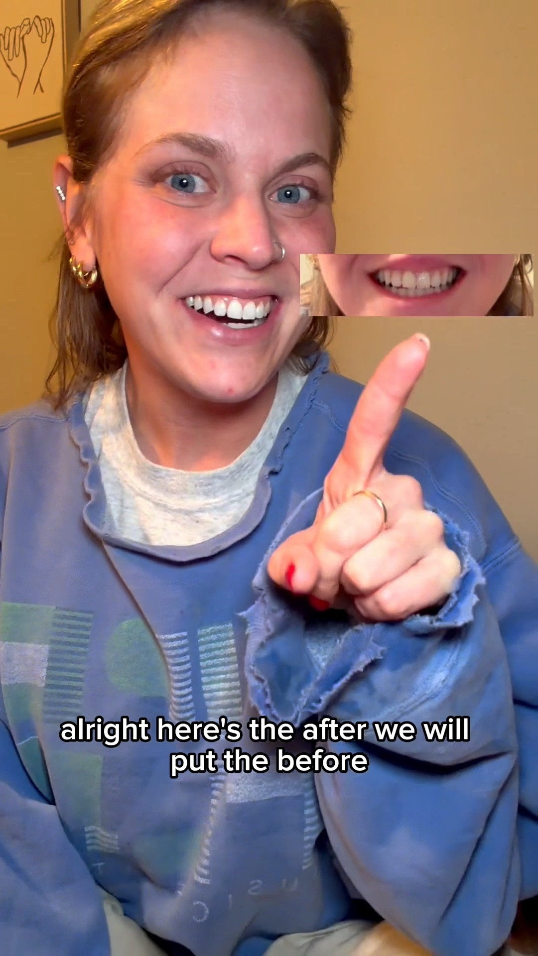 🦷 $20 whitening with zero sensitivity + a mini lesson in color theory  💛💜
Add this must try to your morning or night routine!
- 14 treatments
- enamel safe

#LTKUnder20 #LTKBathroom #amazonfinds #nighttimeroutine #beautyhack #education #cosmetologistapproved #bedtime

#LTKselfcare #LTKgrwm #LTKHome #LTKBeauty