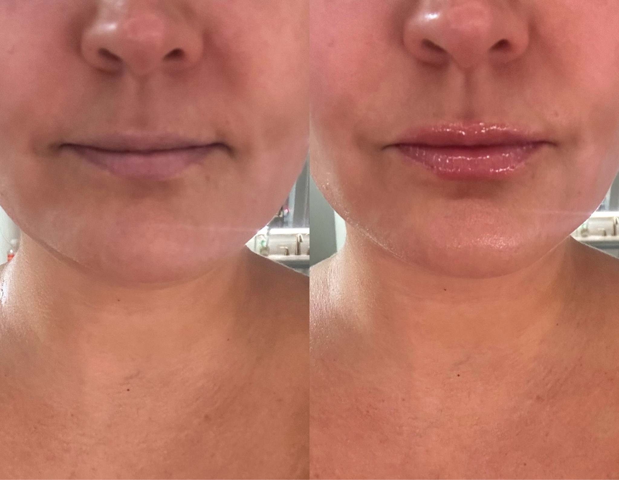 Take it from me (a lil lips girly) this plumper is everything! 

#LTKBeauty #LTKSaleAlert