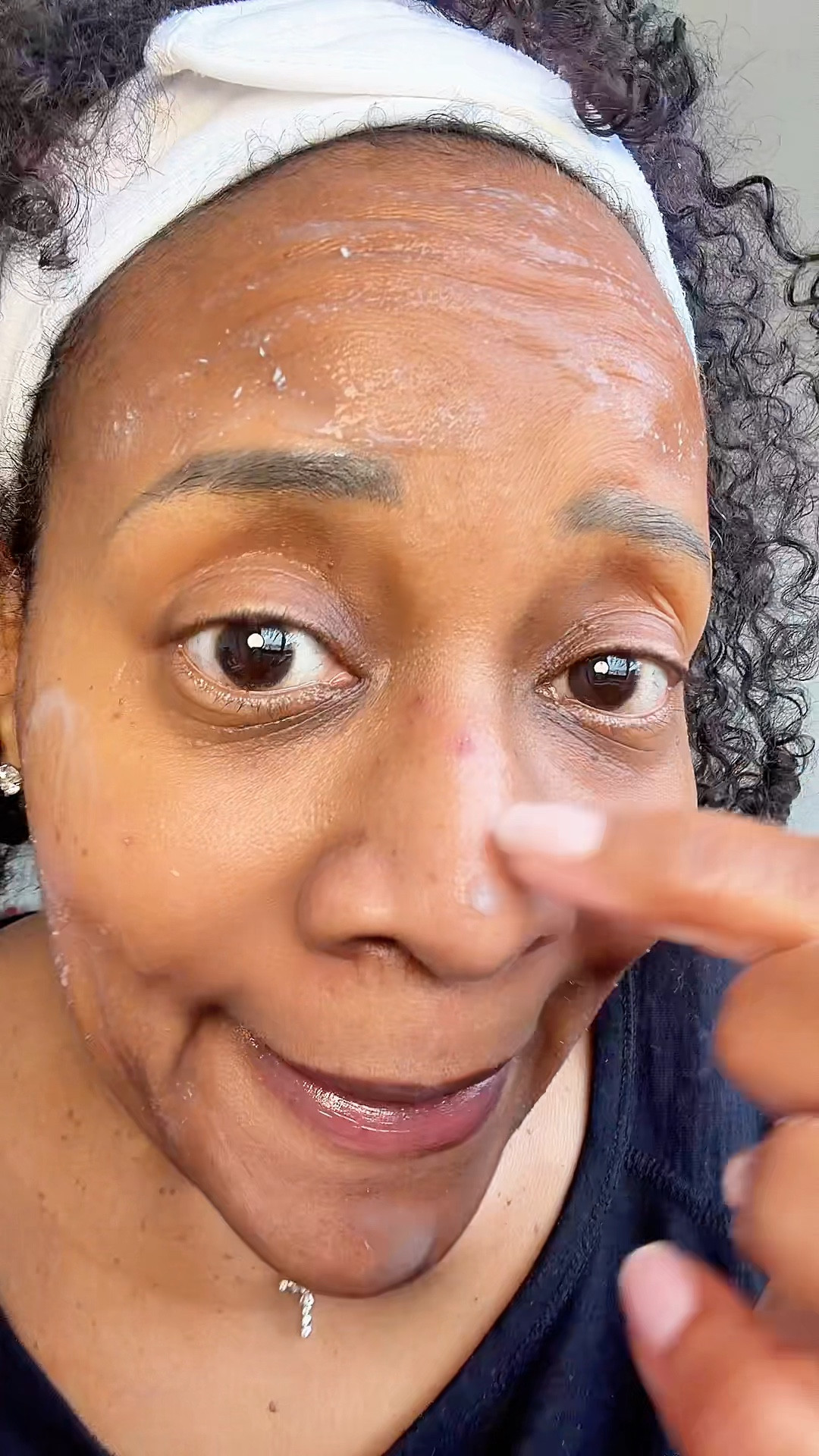 Hormonal adult acne help 💁🏾‍♀️

#LTKBeauty #LTKOver40 #LTKselfcare