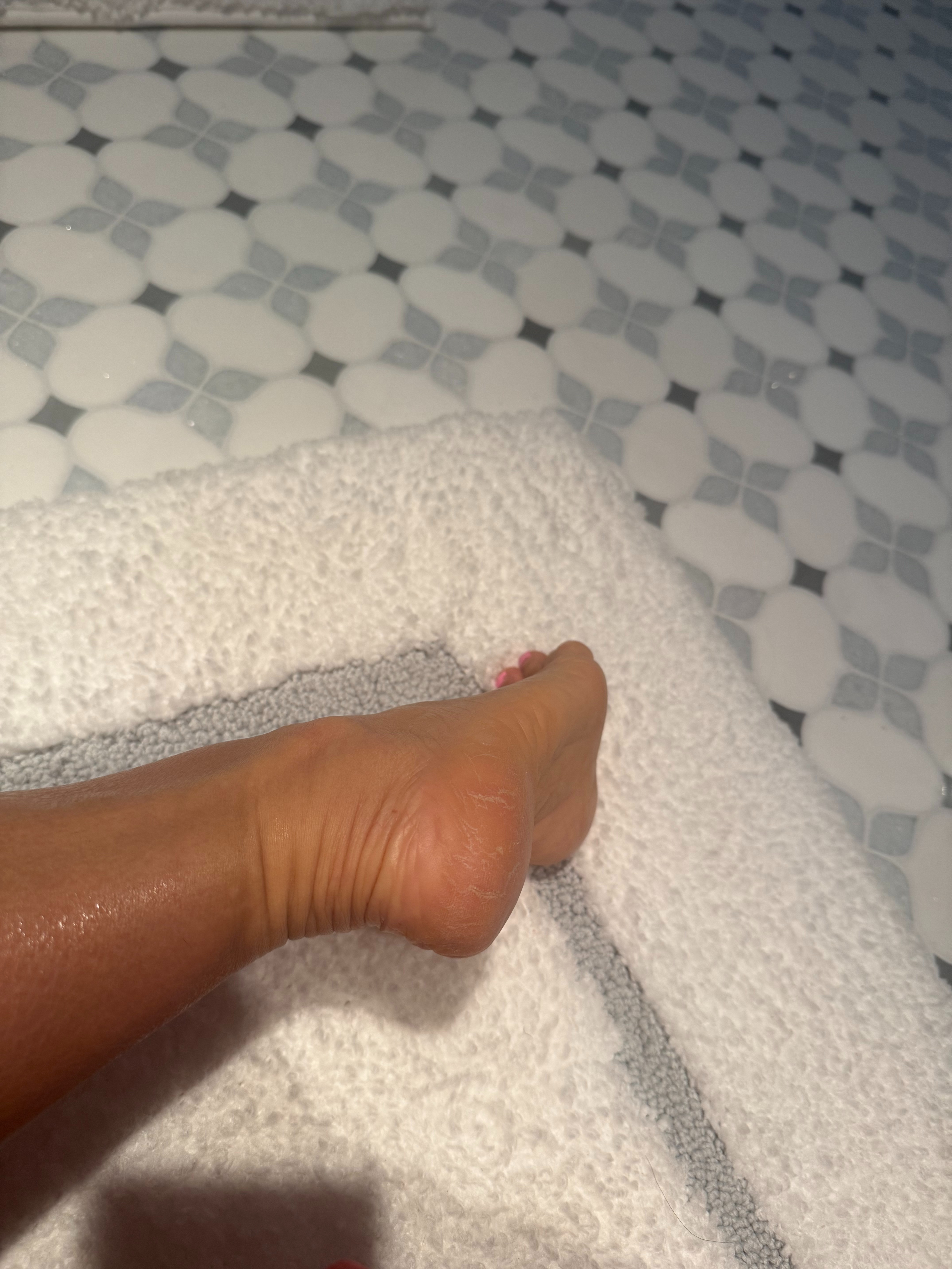 The best things to use for cracked heels 

 