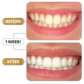 Lumineux Teeth Whitening Strips 9 Treatments – Peroxide Free - Enamel Safe for Whiter Teeth - W... | Amazon (US)