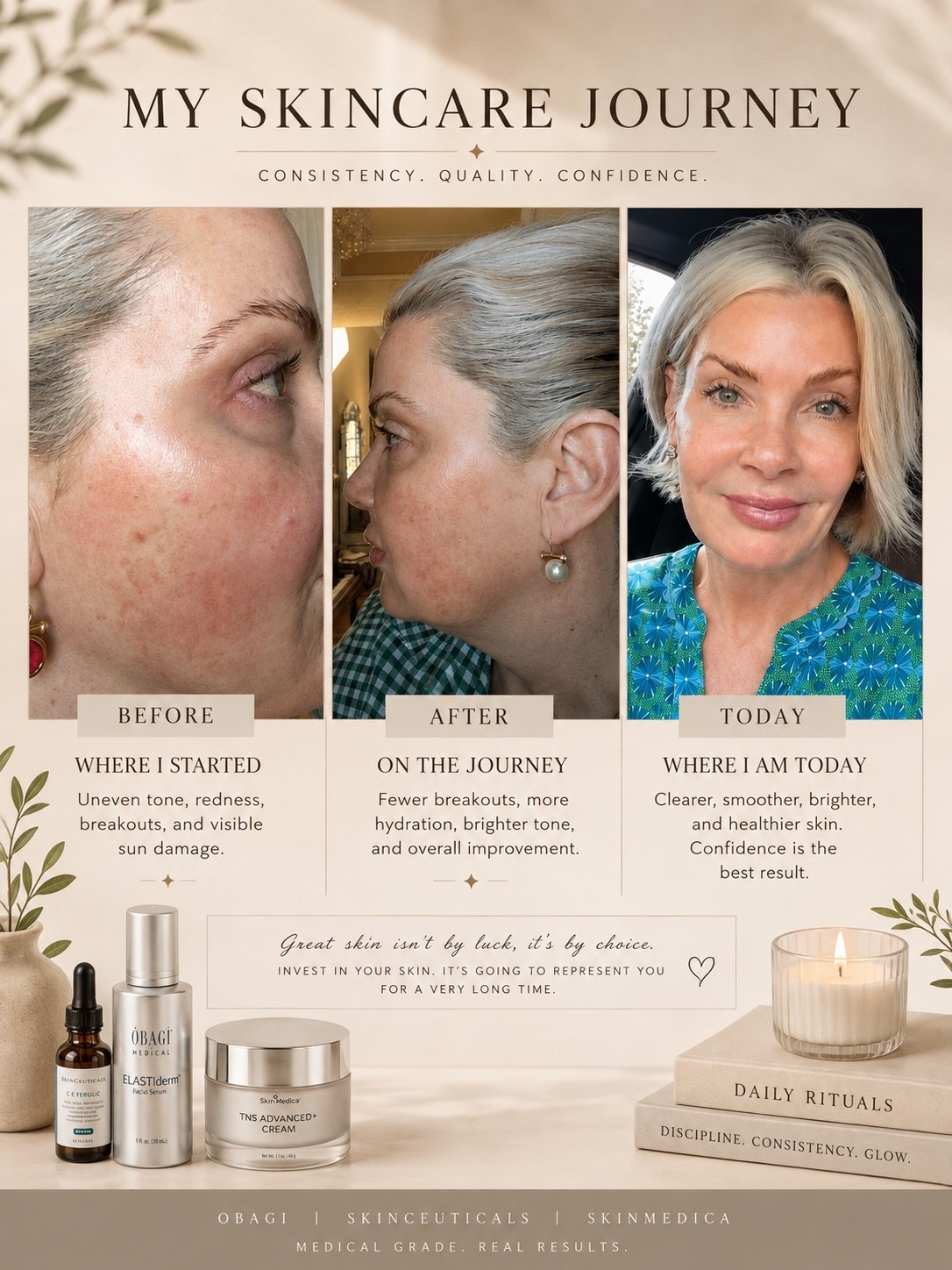 From January 2025 to today… what a difference consistency has made. ✨

I’ve linked the medical-grade skincare products that have become part of my weekly routine from Obagi, SkinCeuticals, and SkinMedica. This regimen was customized specifically for my skin and my concerns, which is why it’s worked so well for me.

Your skin has its own unique needs, so I always recommend meeting with a licensed aesthetic provider to create a plan that’s right for you. What works beautifully for my skin may not be the best fit for yours, and that’s exactly why personalized skincare matters.

Healthy skin isn’t about perfection. It’s about consistency. 🤍

#LTKselfcare #LTKBeauty #LTKgrwm