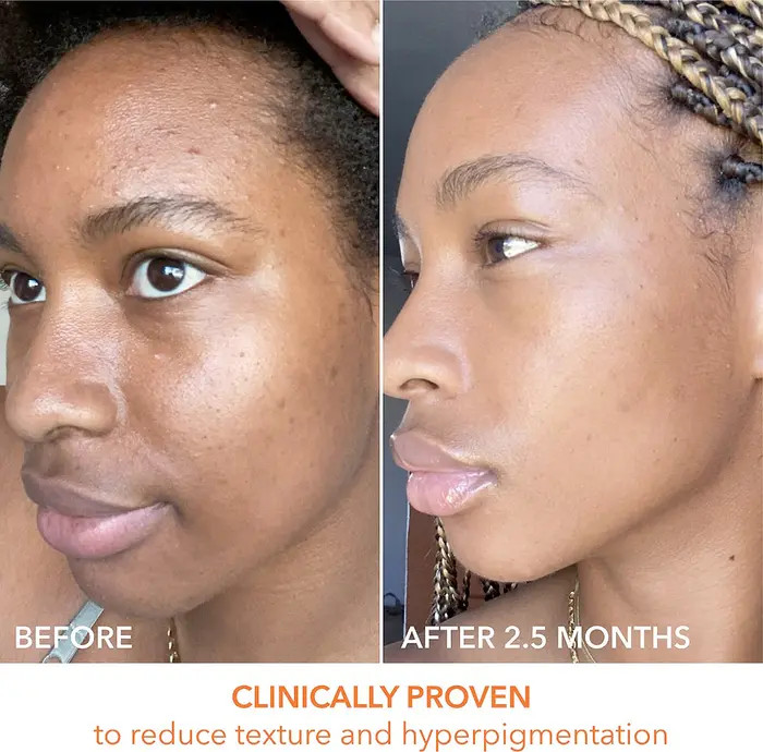 Alpha Beta® Peel Original Formula - 30 Applications | Nordstrom