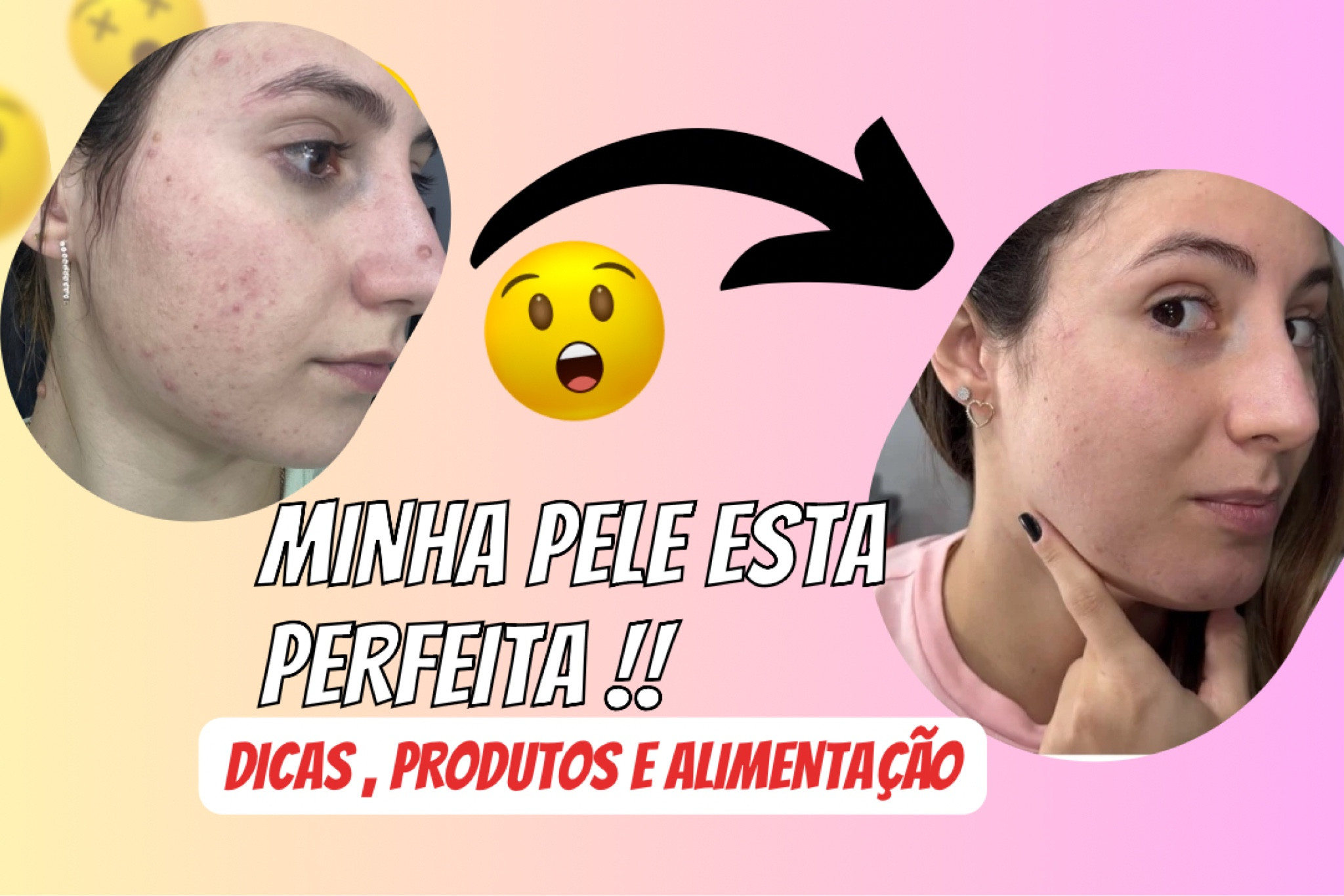 Produtos mencionados ao meu vídeo de dicas de cuidados com a pele para acne 

#LTKbeleza #LTKpromo #LTKdicadeestilo