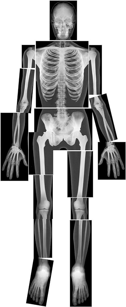 Roylco True to Life Human X-Rays | Amazon (US)