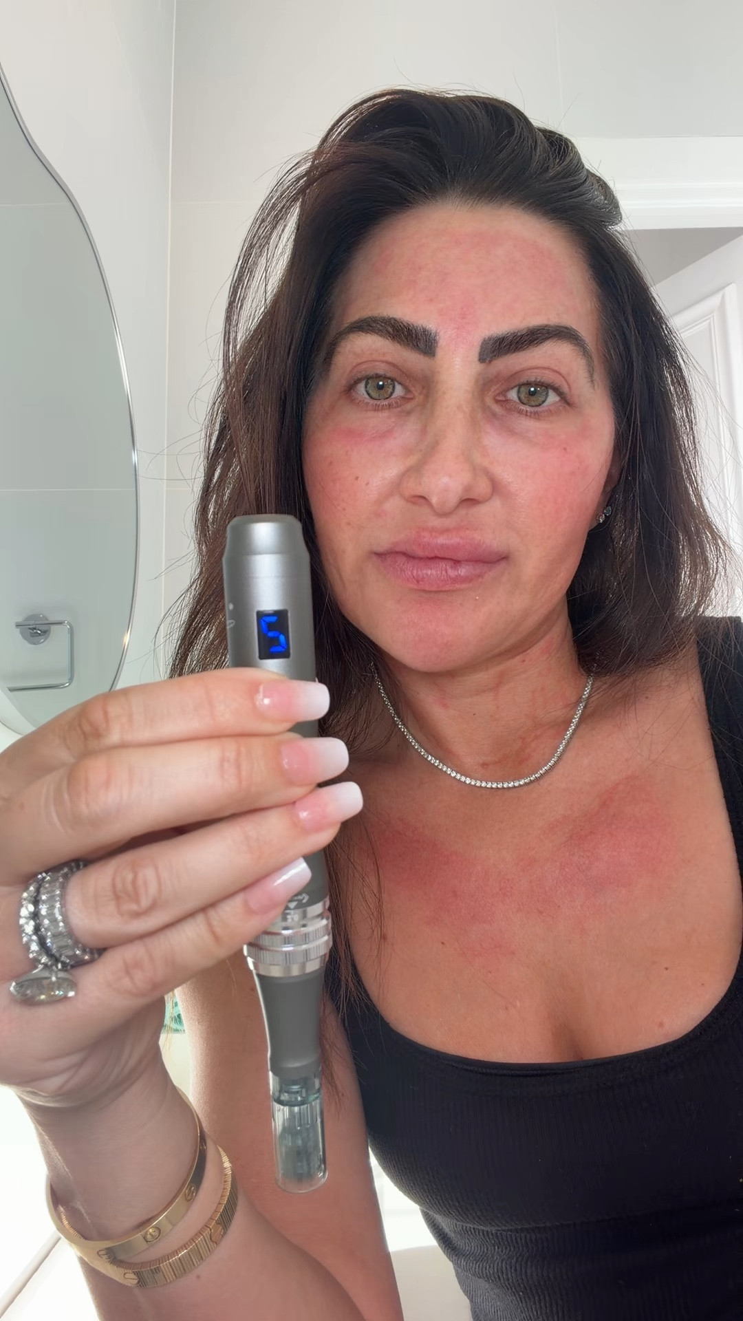 At home micro needling that works!! 

#microneedling #skinglow #skincare

#LTKBeauty #LTKselfcare #LTKmomlife