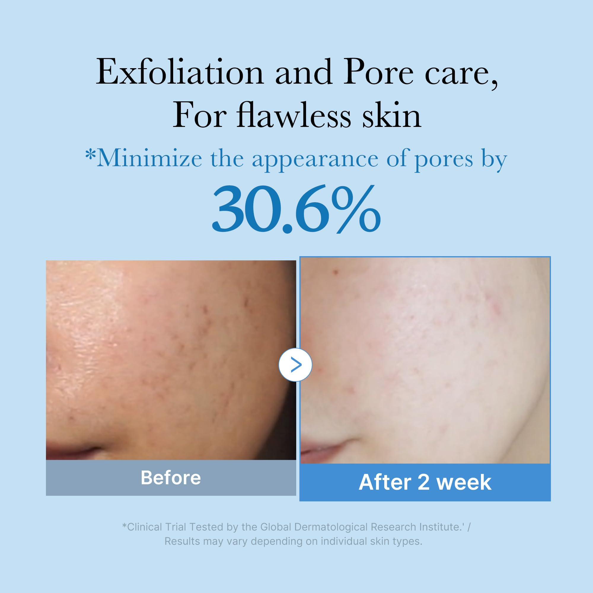 medicube Zero Pore Toner I Exfoliating & Hydrating Blue Bottle Water Toner with AHA, BHA, PHA, Ni... | Amazon (US)