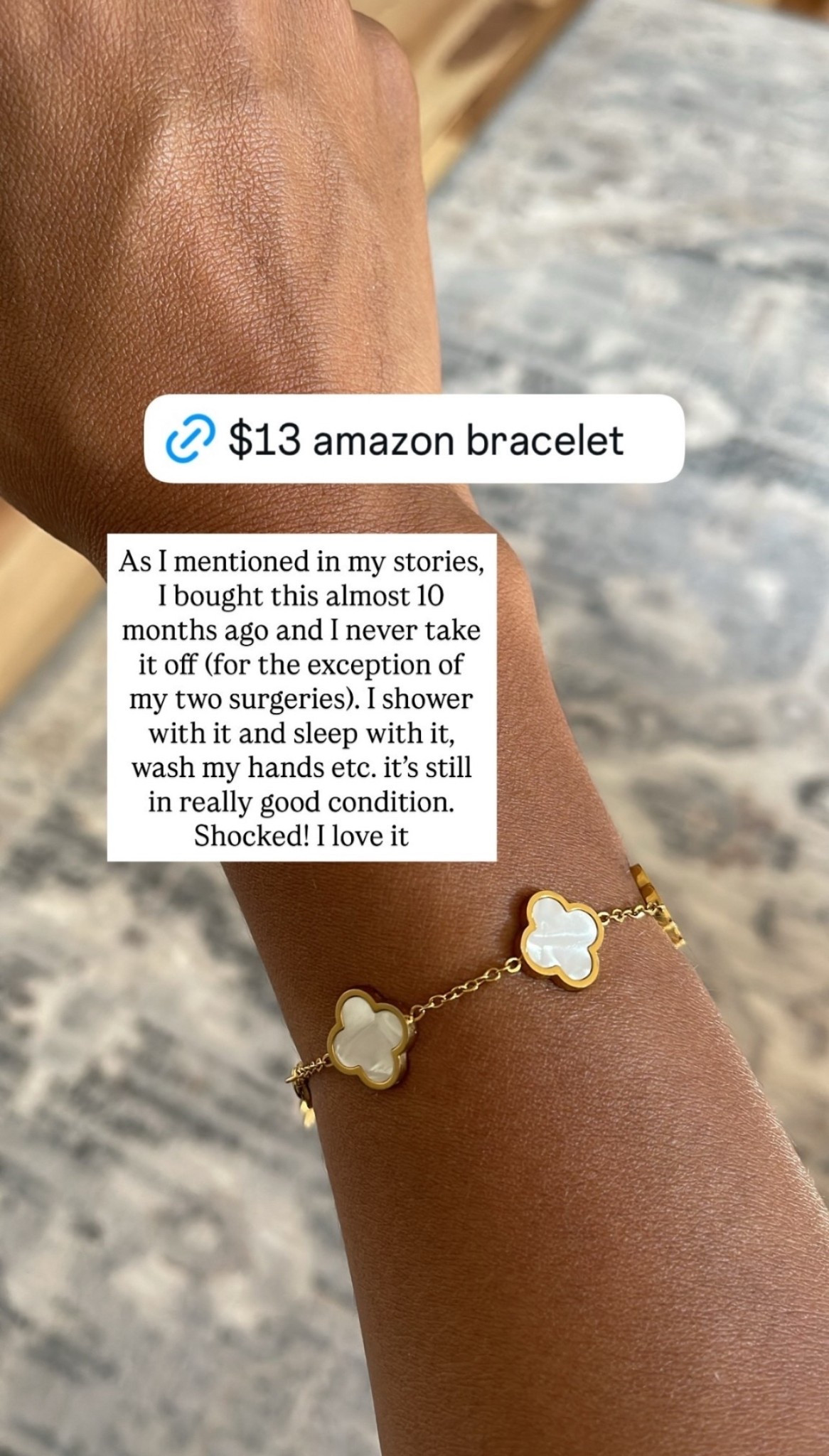 As I mentioned in my stories, I bought this almost 10 months ago and I never take it off (for the exception of my two surgeries). I shower with it and sleep with it, wash my hands etc. it’s still in really good condition. Shocked! I love it

