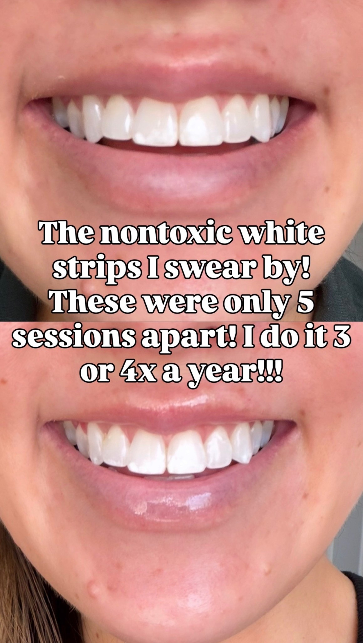 Nontoxic and they actually work!!

whitening stripes, women’s wellness, nontoxic whitening strips, lumineux 