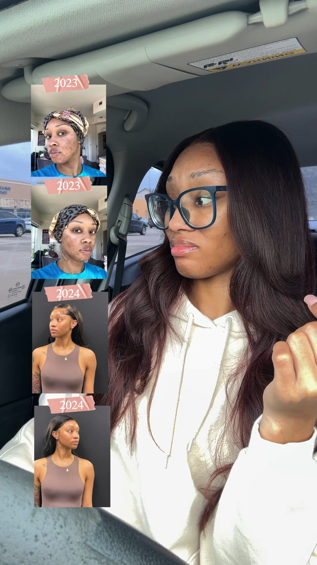 this routine came from learning what my skin actually needs, not what’s viral that week.
everything i use is linked.


acne prone skin, ulta skincare, acne skincare routine, sensitive skin routine, eczema prone skin, salicylic acid cleanser, gentle face cleanser, dark spot treatment, acne spot treatment, spf moisturizer, skincare for breakouts, intentional skincare, skincare maintenance


#LTKgrwm #LTKselfcare #LTKBeauty