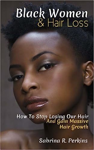 Black Women & Hair Loss: How To Stop Losing Our Hair & Gain Massive Hair Growth | Amazon (US)