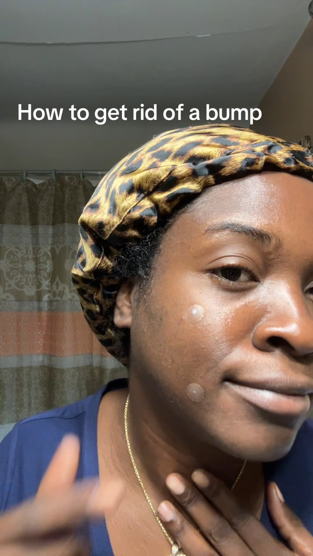 Got rid of two bumps in less then 15 hours 

#LTKBump #LTKSeasonal #LTKBeauty