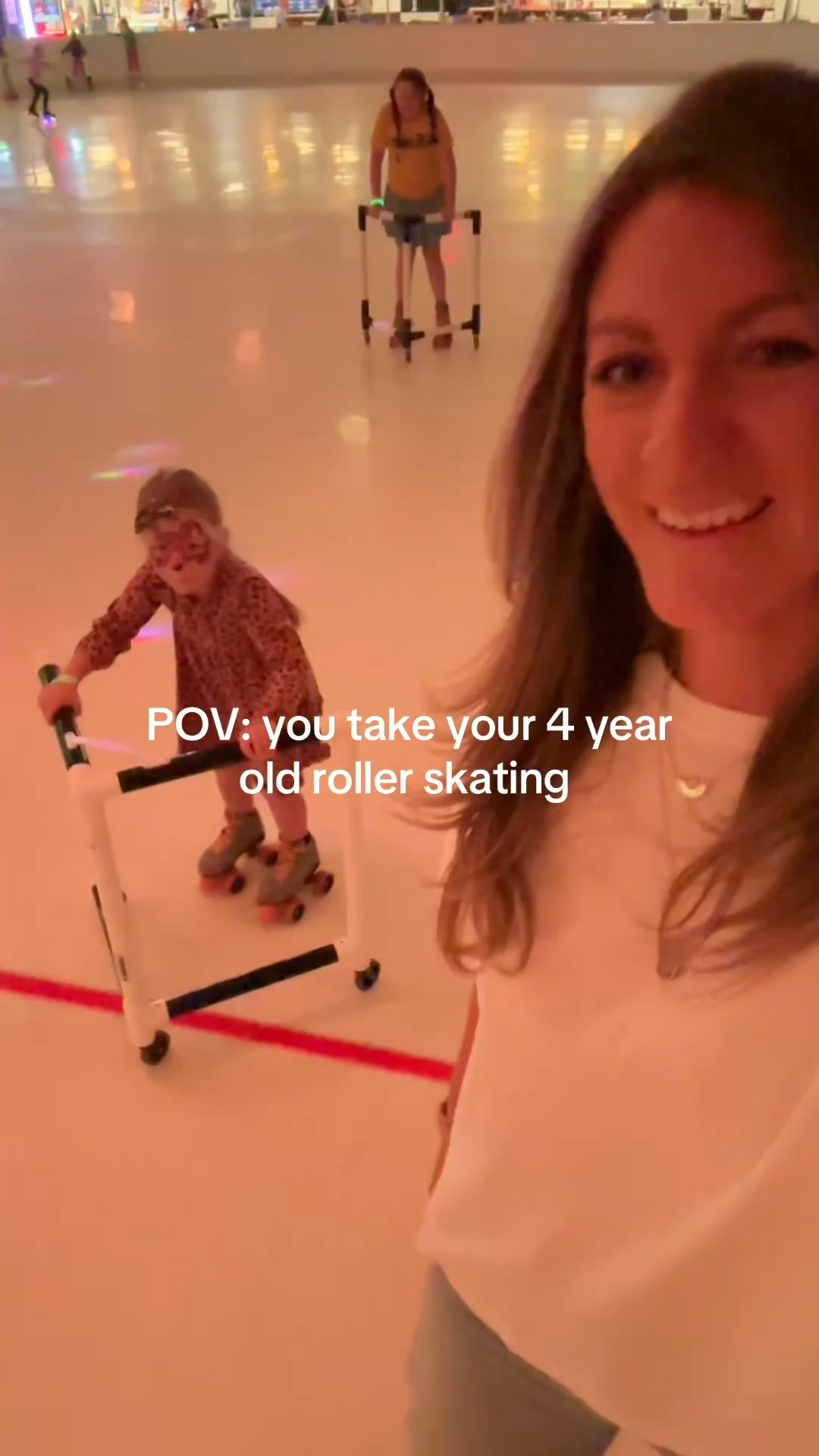 For Halloween I got a radial head fracture 🫠