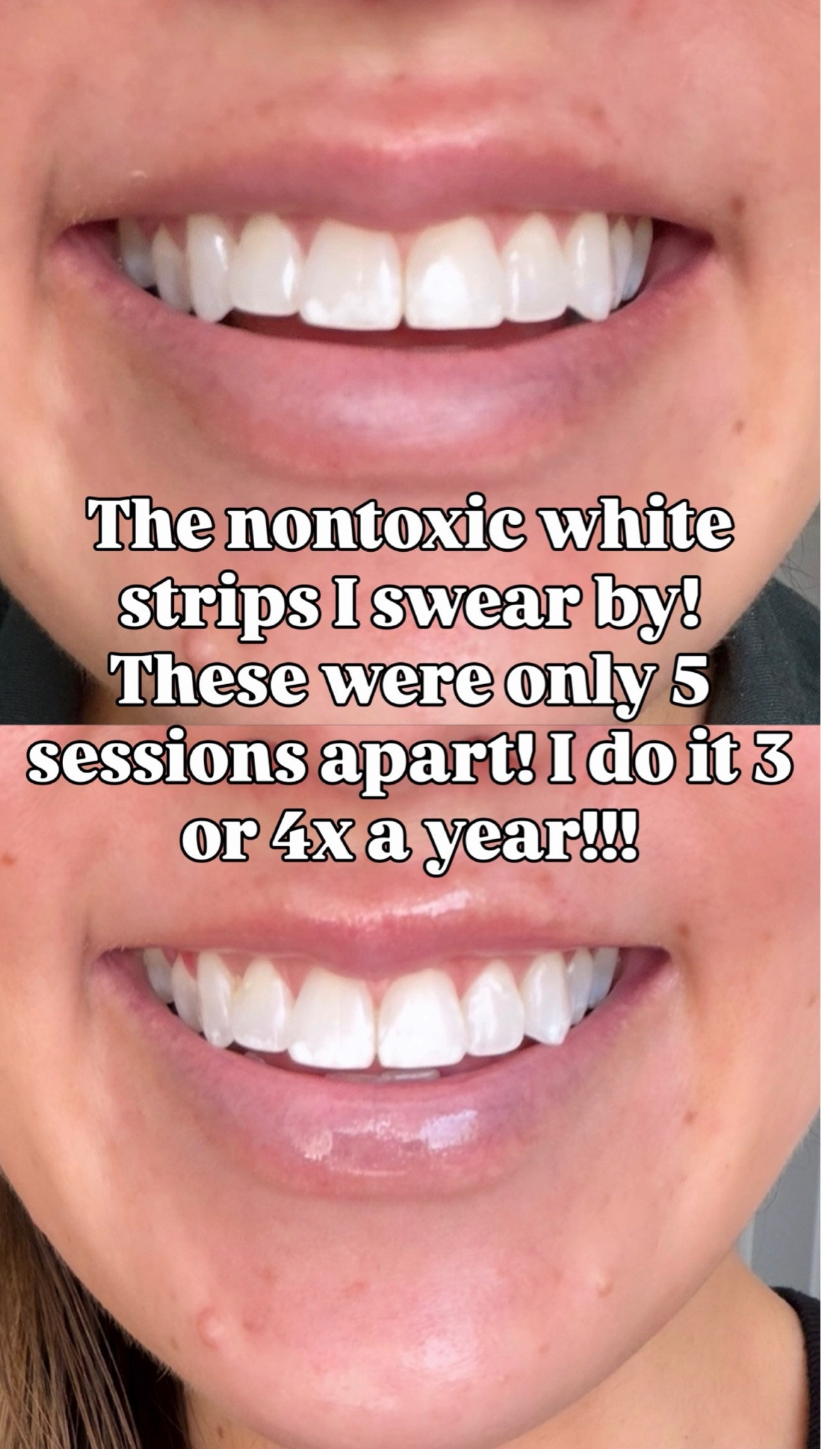 nontoxic AND effective!! 

whitening strips, Amazon must haves, wellness must haves, women’s must haves, nontoxic whitening strips