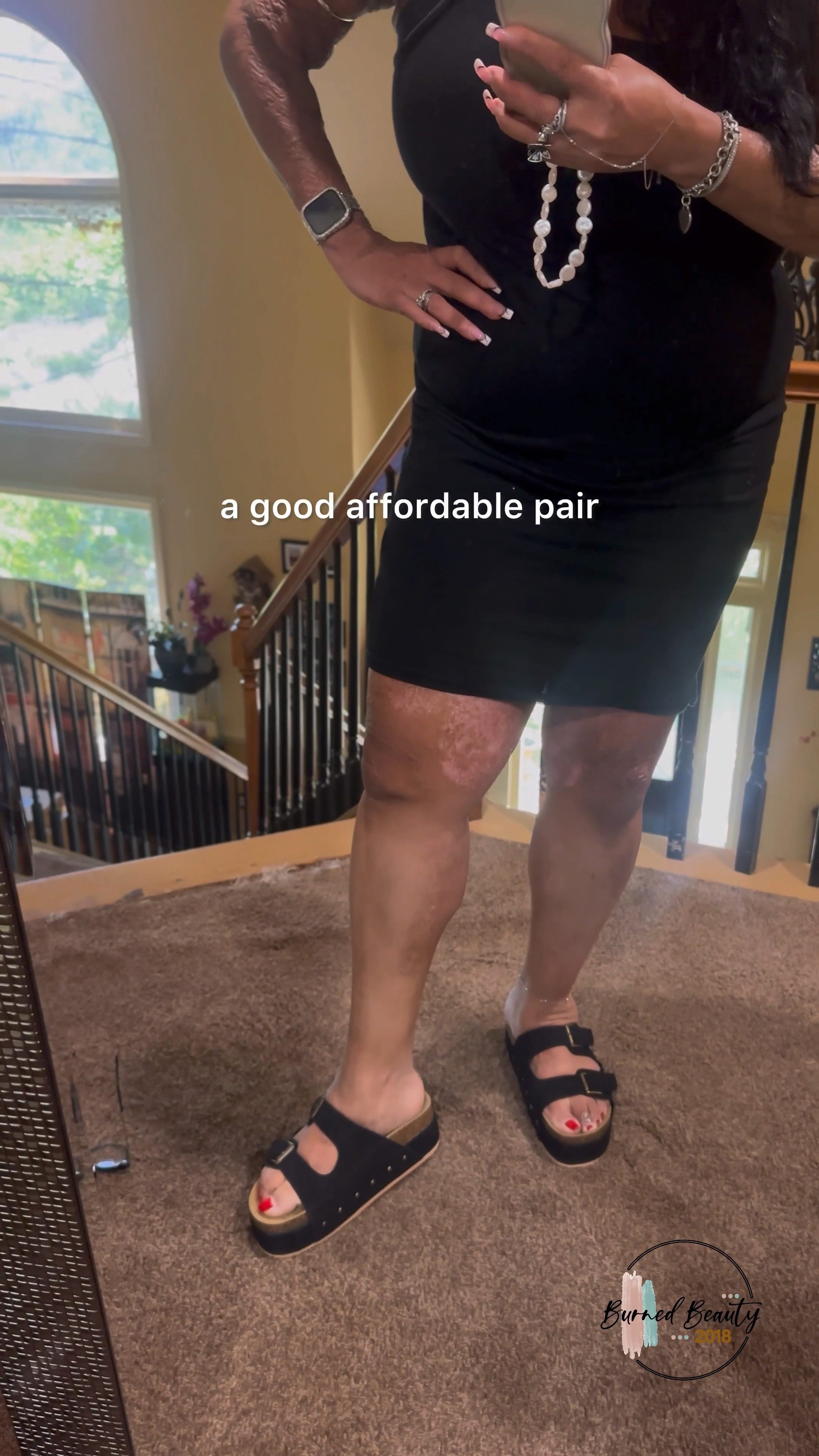 Platform Slide Sandals from Amazon. They’re lightweight and comfortable. They are true to size length wise, but I believe they run wide. They fit my extremely wide foot right out of the box. 
🦋

I measured these and they are under 2 inches. Just barely. They are lightweight and I will still be wearing them, but I did get another pair by another brand with the full 2 1/2 inch platform. My review on those is on LTK as well.

platform birkenstocks, summer sandals, slides, chunky sandals 

#LTKOver40 #LTKVideo #LTKShoeCrush