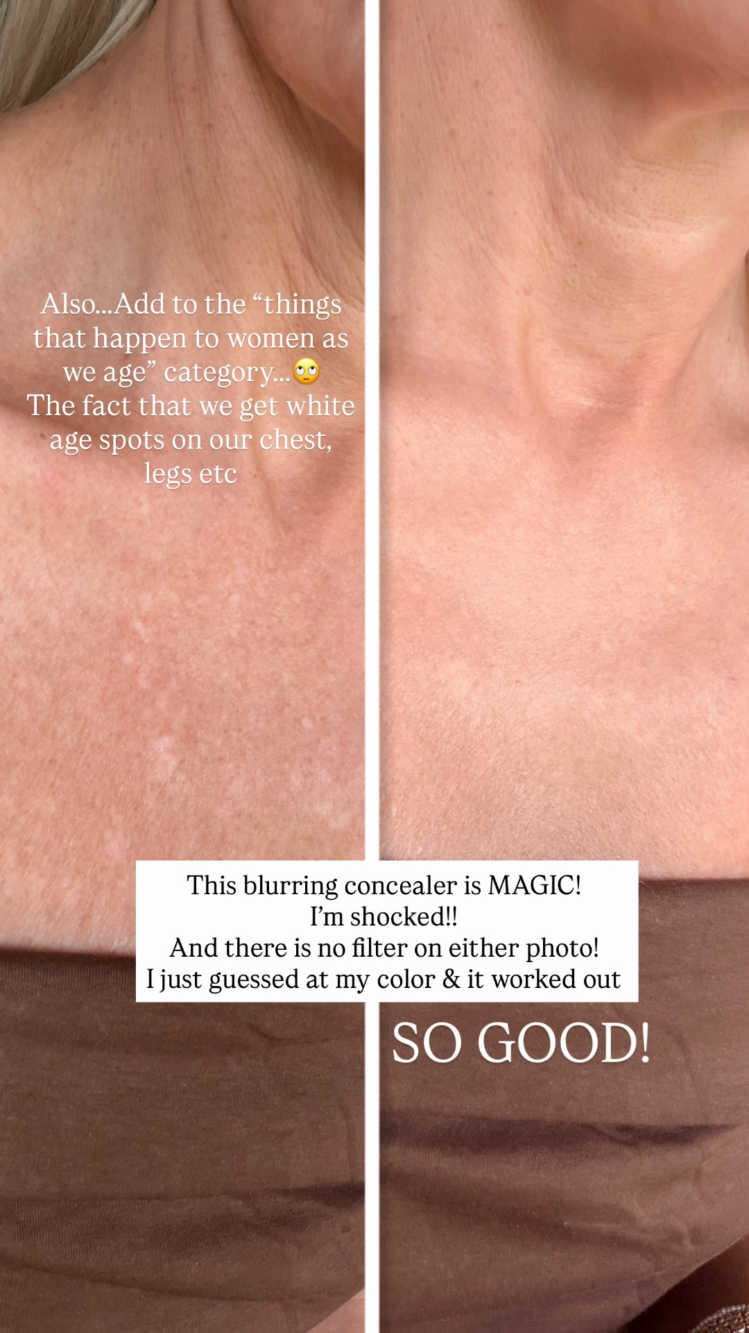 I thought it might work, but I’m actually shocked at how well it works! This is great for an evening out where you may have a blouse or a dress where your chest is showing, etc.
Concealer that helps to blur over your skin 
￼

#LTKBeauty #LTKselfcare #LTKOver40
