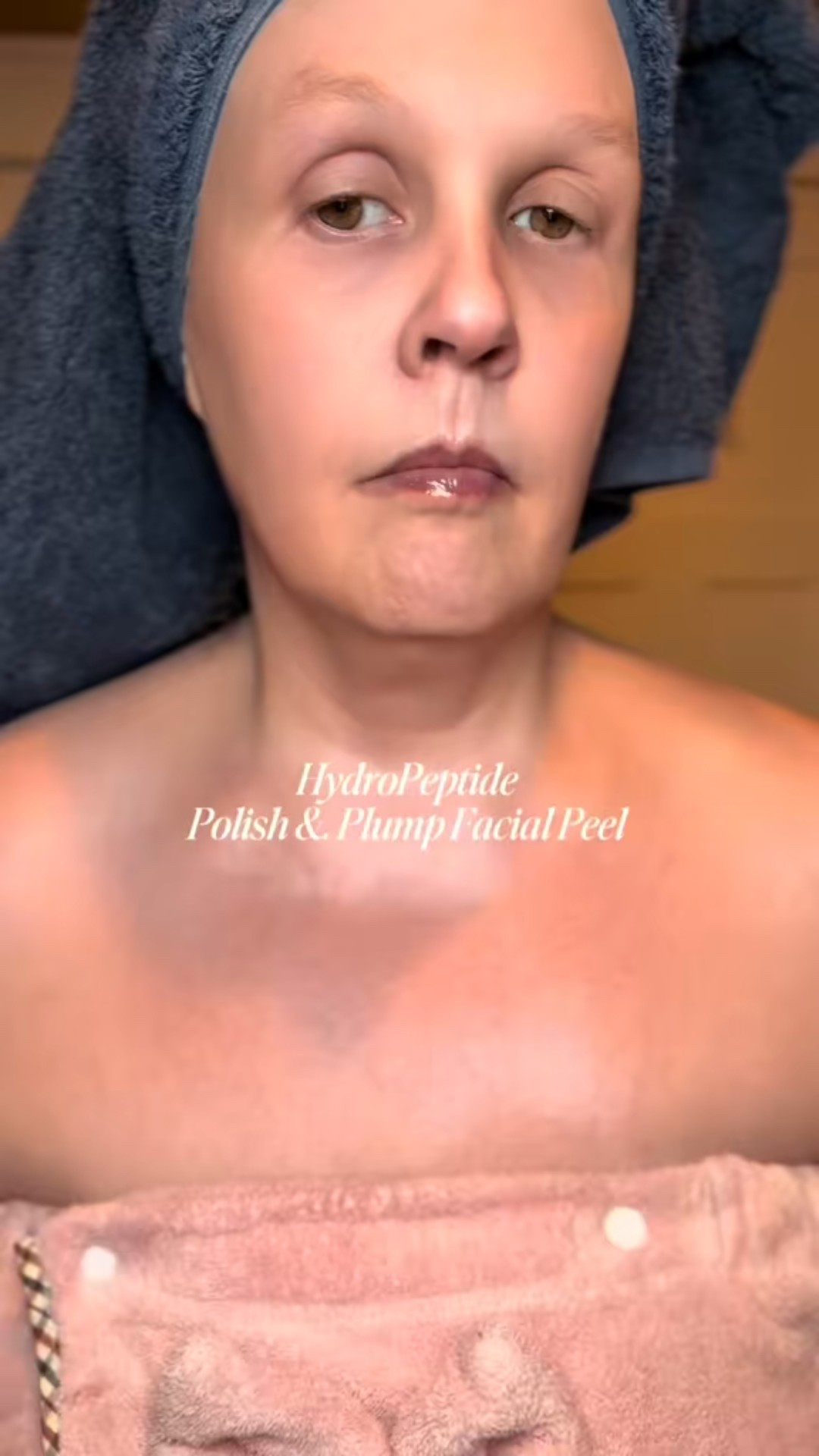 Best at home Peel I have ever done! I said what I said🎤The BEST! #hydropeptide #facial #skincaretips #antiaging

#LTKOver40 #LTKBeauty #LTKselfcare