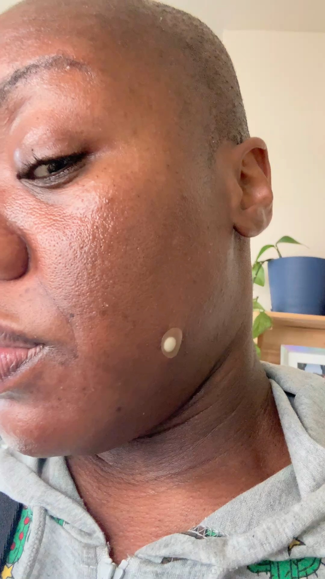 My favorite acne dots for pesky pimples. 

Acne, acne dots, pimples, breakouts, Sephora, Sephora sale, LTKfestival 

#LTKU #LTKdayinmylife #LTKBeauty