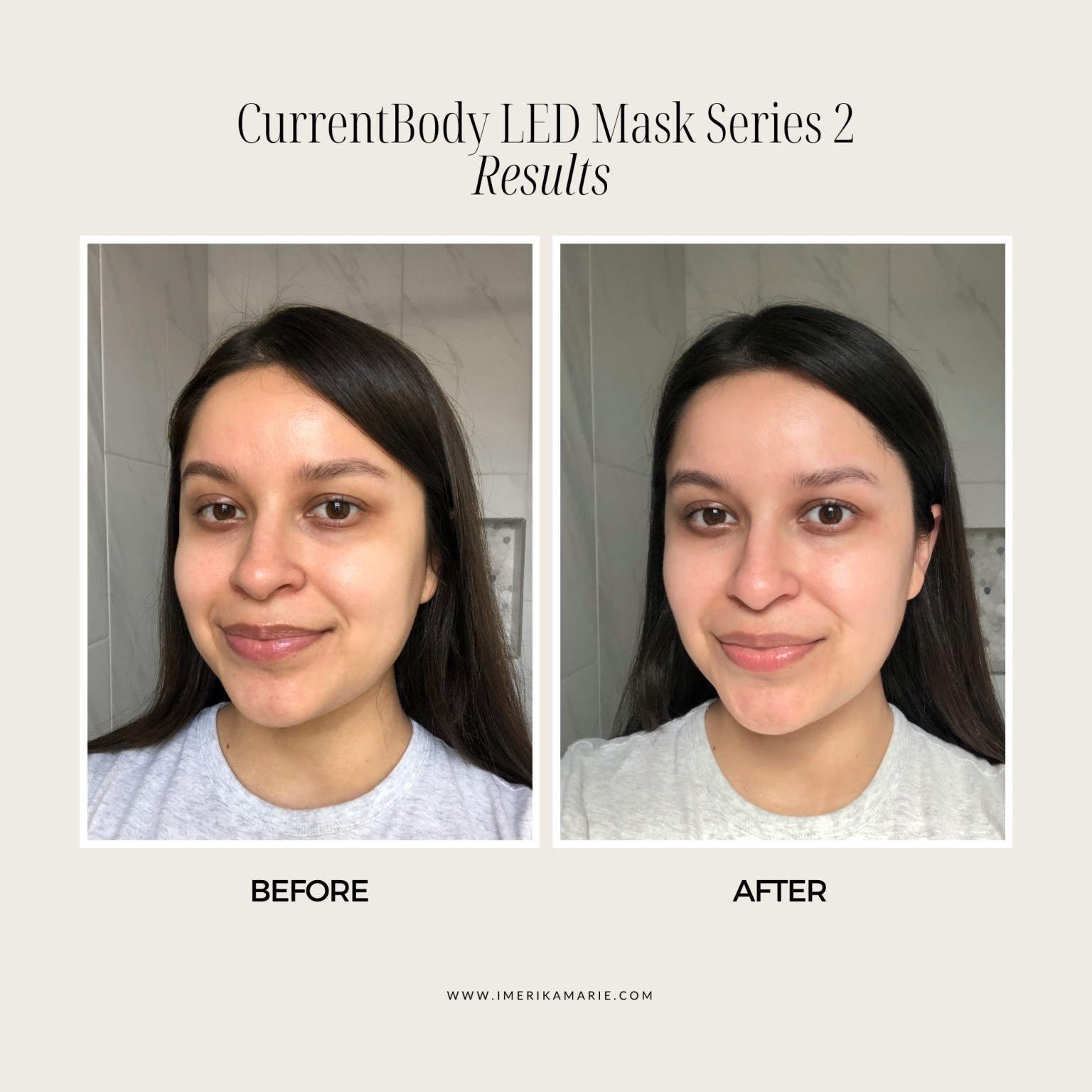 Results from the CurrentBody Red Light Therapy Mask, perfect for a Mother’s Day gift 🤍

Use code “ERIKALED” to save $$

The @currentbody01 LED mask is my favorite for anti-aging, brightening skin and improving skin texture.

mother’s day gift, mothers gifts, mom gifts, ltkmothersday, mother’s day gift guide, mom skincare

#LTKMothersDay #LTKBeauty #LTKselfcare