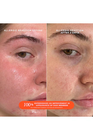 SOS Daily Rescue Facial Spray with Hypochlorous Acid 1oz | Revolve Clothing (Global)