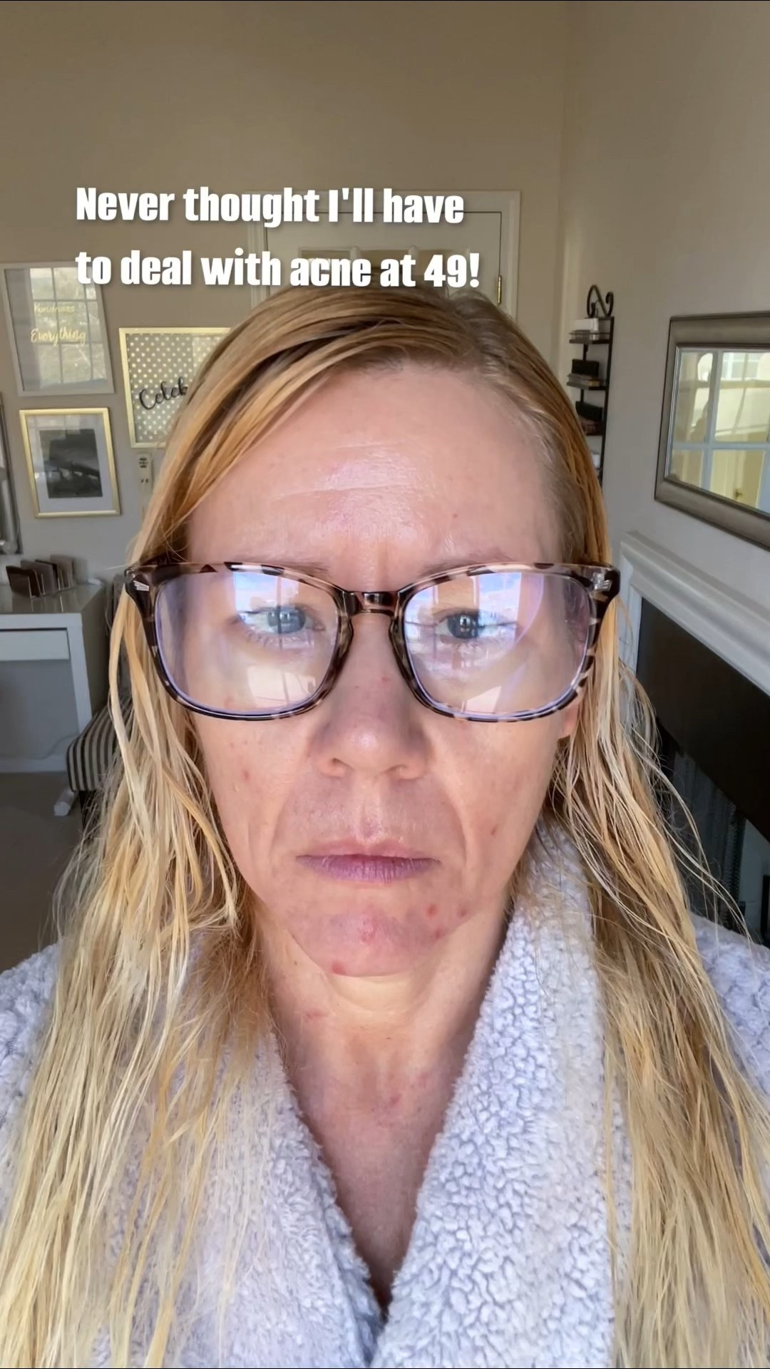 #giftedbyPixi I never thought I’d have to deal with acne at 49! I did not have acne as a teenager… feeling like I am in puberty lol…

Thank your for bringing back my GLOW @Pixi

Too Faced born this way concealer shade „natural beige"

#LTKBeauty #LTKOver40