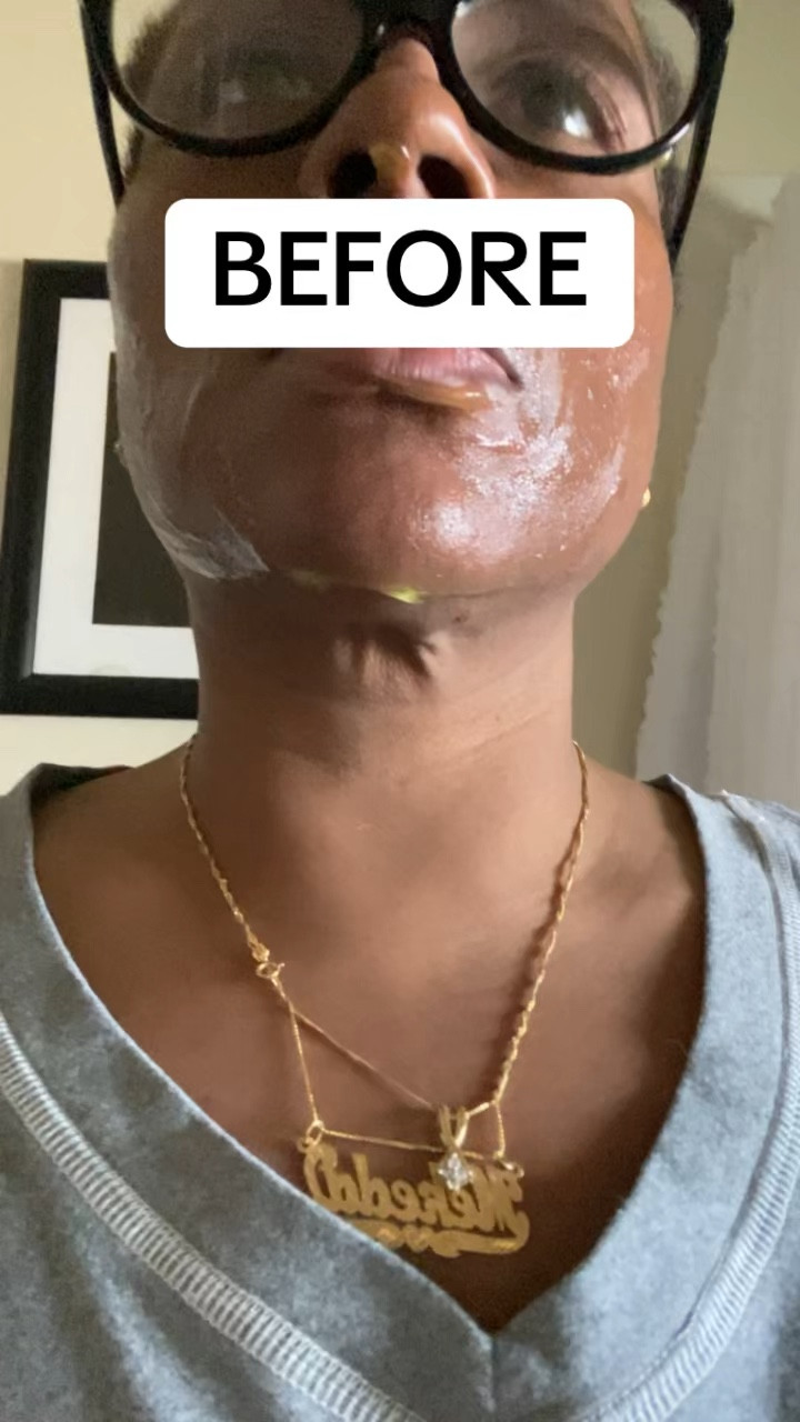 tighten and firm loose saggy neck skin 

#LTKOver40 #LTKBeauty